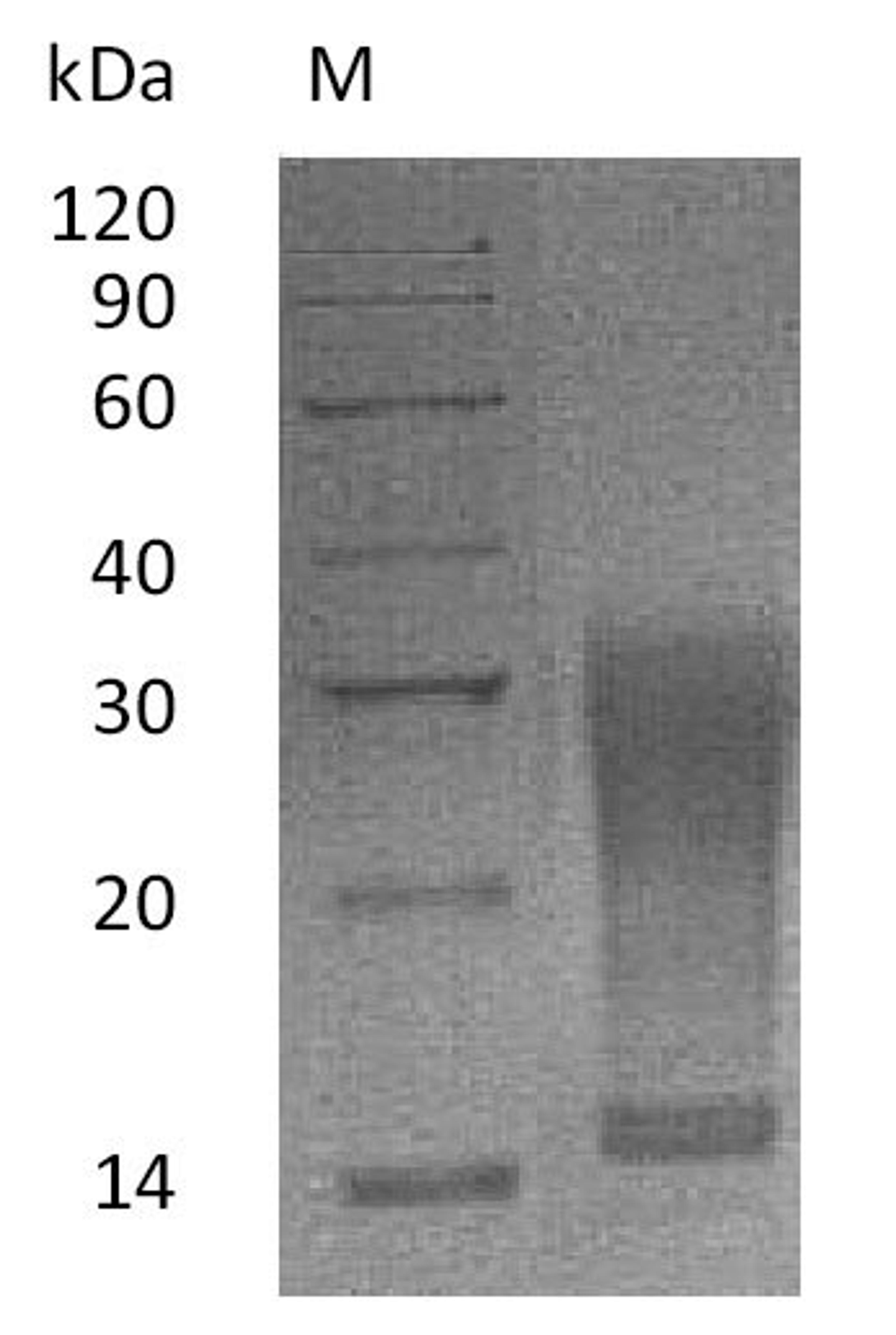 (Tris-Glycine gel) Discontinuous SDS-PAGE (reduced) with 5% enrichment gel and 15% separation gel.