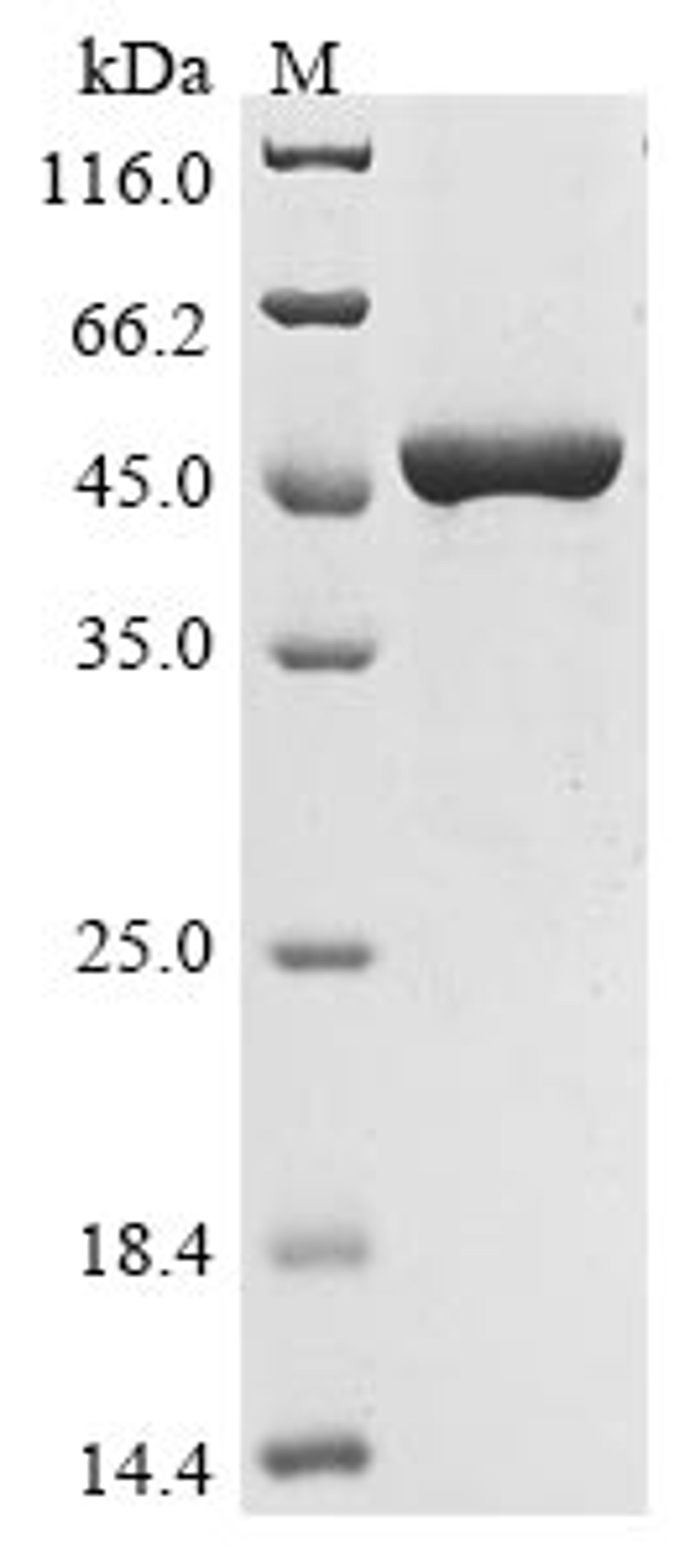 (Tris-Glycine gel) Discontinuous SDS-PAGE (reduced) with 5% enrichment gel and 15% separation gel.