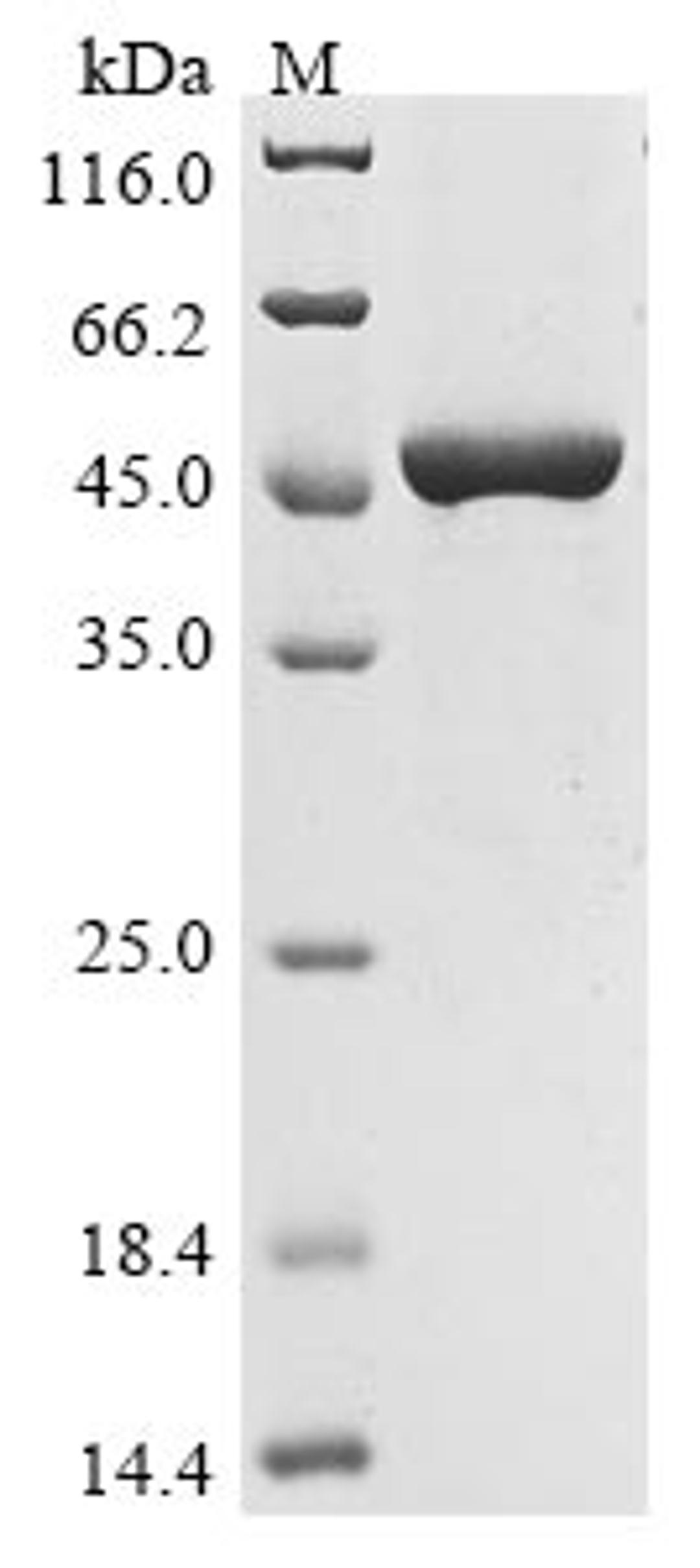 (Tris-Glycine gel) Discontinuous SDS-PAGE (reduced) with 5% enrichment gel and 15% separation gel.