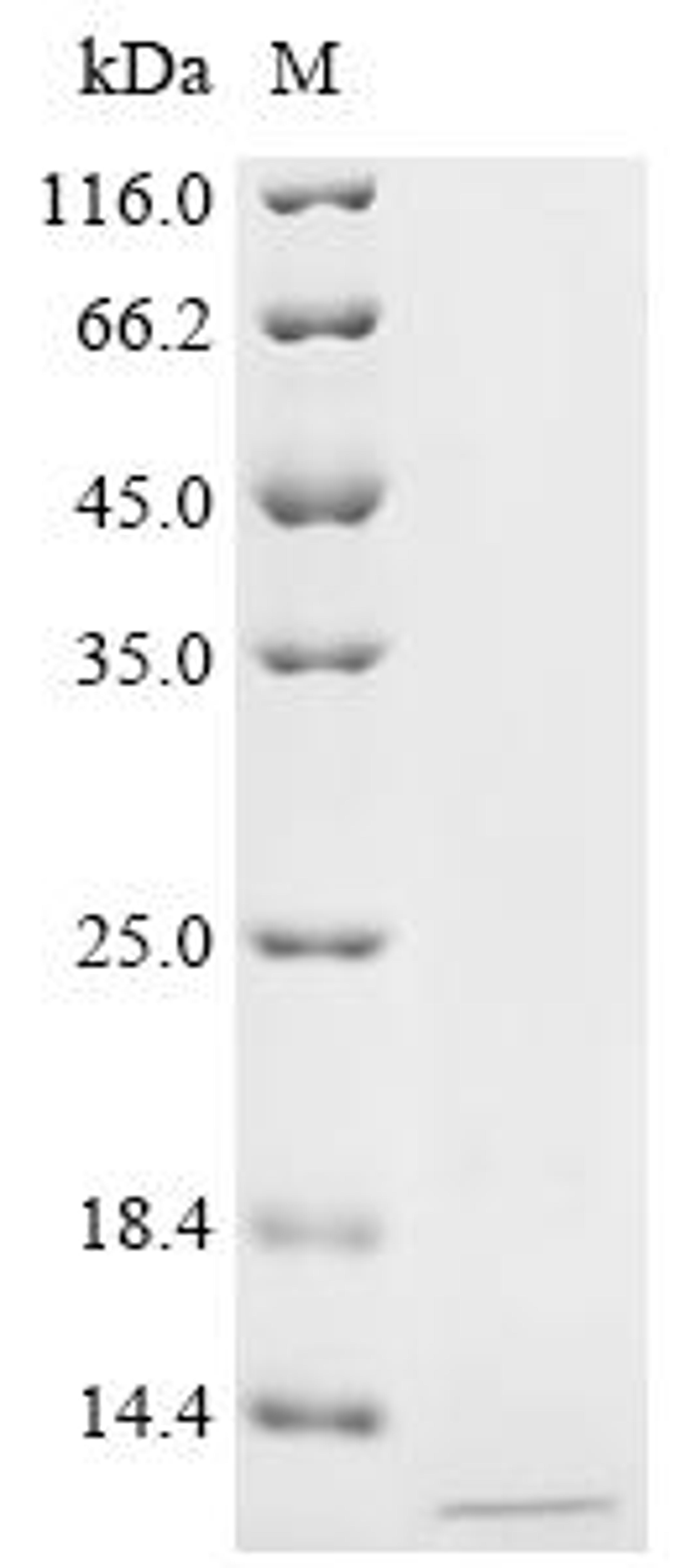 (Tris-Glycine gel) Discontinuous SDS-PAGE (reduced) with 5% enrichment gel and 15% separation gel.