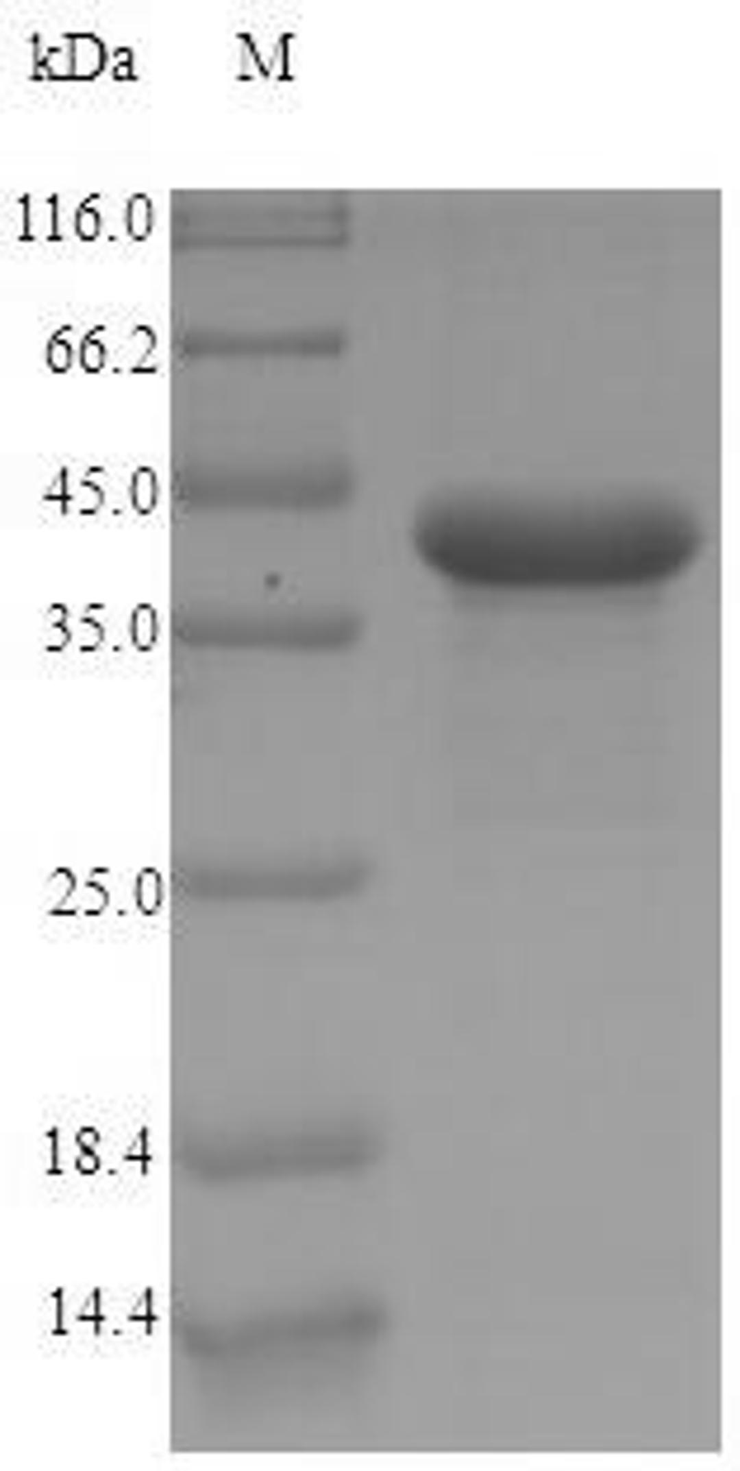 (Tris-Glycine gel) Discontinuous SDS-PAGE (reduced) with 5% enrichment gel and 15% separation gel.