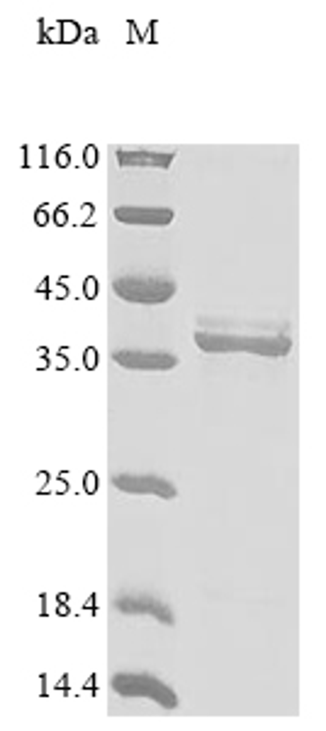 (Tris-Glycine gel) Discontinuous SDS-PAGE (reduced) with 5% enrichment gel and 15% separation gel.
