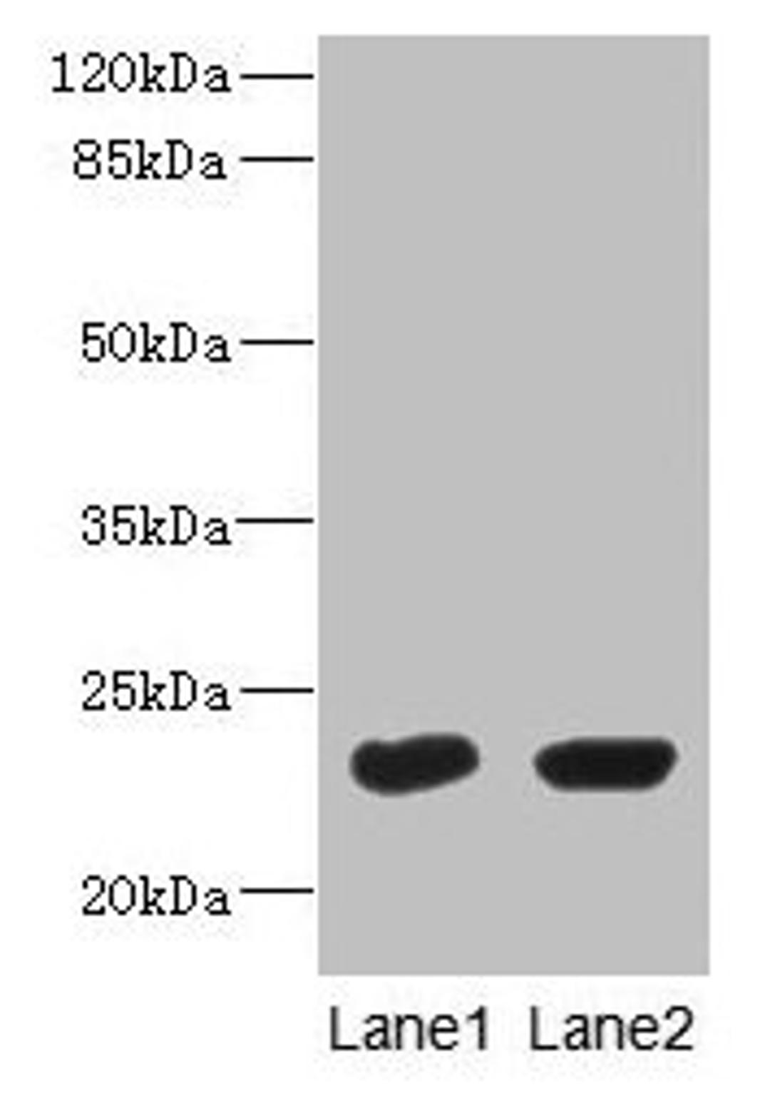 Western Blot. All lanes: UBE2T antibody at 10µg/ml. Lane 1: HepG2 whole cell lysate. Lane 2: Hela whole cell lysate. Secondary. Goat polyclonal to rabbit IgG at 1/10000 dilution. Predicted band size: 23 kDa. Observed band size: 23 kDa