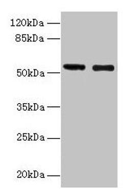 Western blot. All lanes: GLP1R antibody at 12µg/ml. Lane 1: Mouse heart tissue. Lane 2: 293T whole cell lysate. Secondary. Goat polyclonal to rabbit IgG at 1/10000 dilution. Predicted band size: 54 kDa. Observed band size: 54 kDa