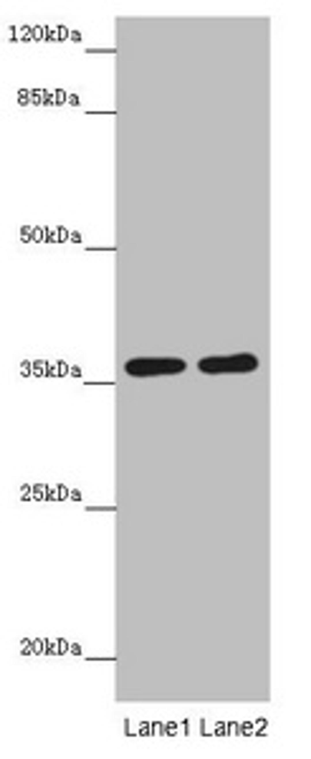 Western blot. All lanes: GNB1L antibody at 3.69µg/ml. Lane 1: Mouse brain tissue. Lane 2: Jurkat whole cell lysate. Secondary. Goat polyclonal to rabbit IgG at 1/10000 dilution. Predicted band size: 36, 23 kDa. Observed band size: 36 kDa