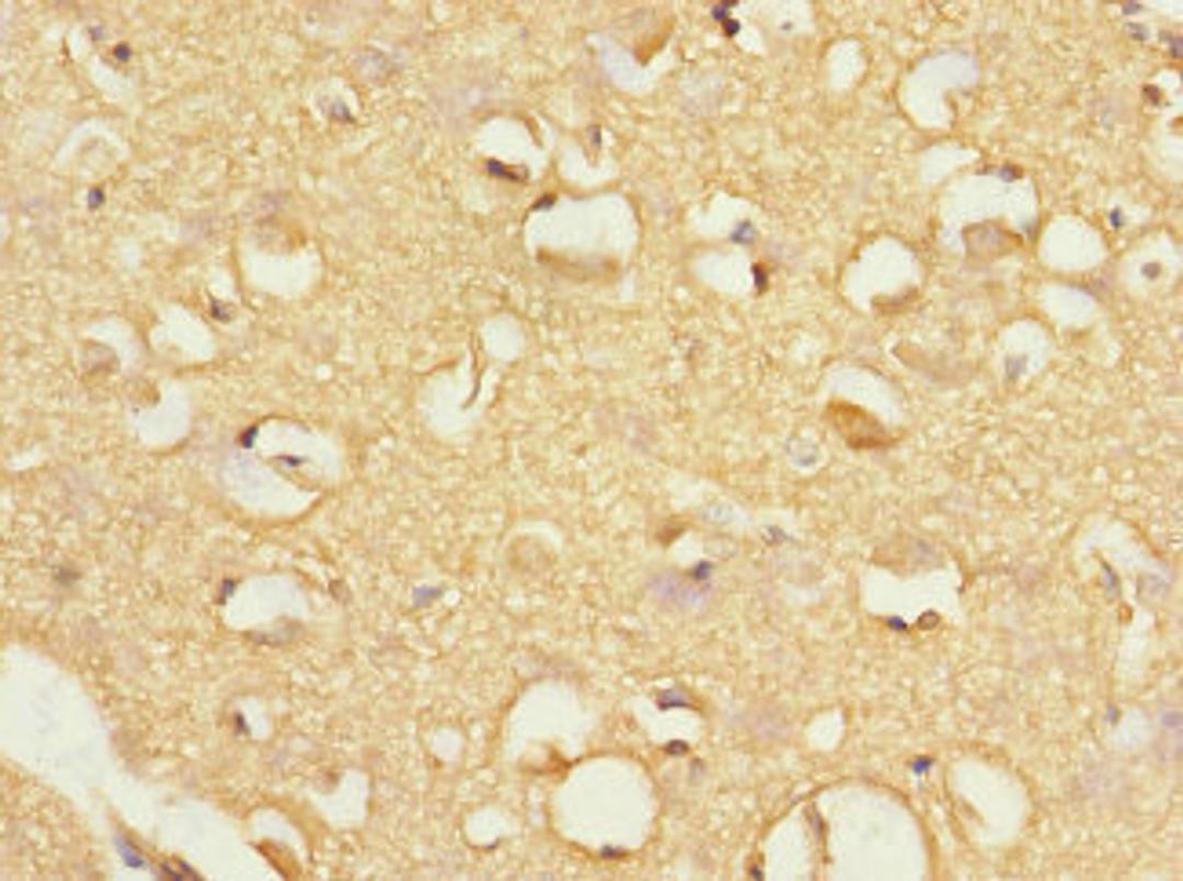 Immunohistochemistry of paraffin-embedded human brain tissue using CSB-PA891538ESR2HU at dilution of 1:100