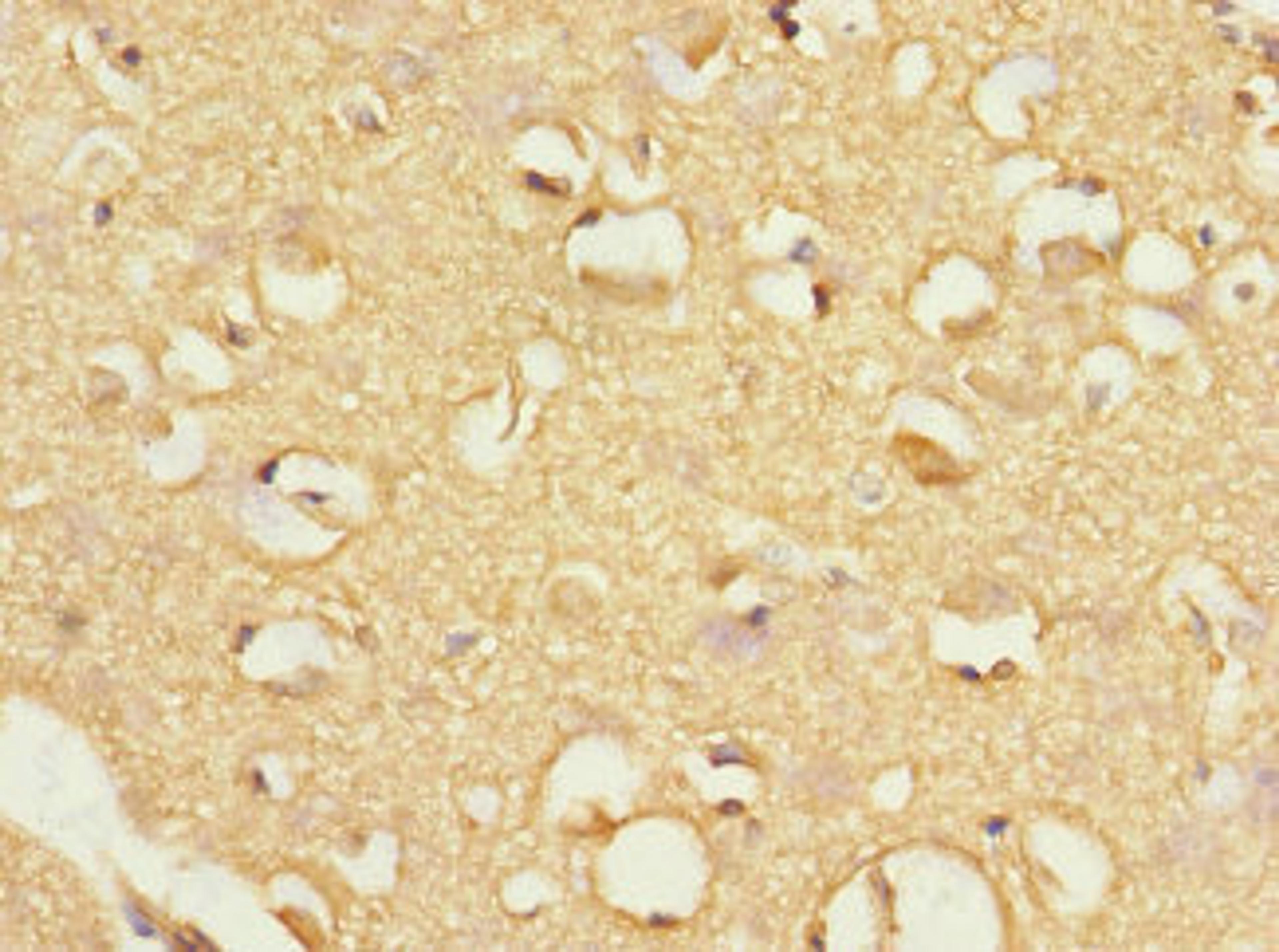 Immunohistochemistry of paraffin-embedded human brain tissue using CSB-PA891538ESR2HU at dilution of 1:100