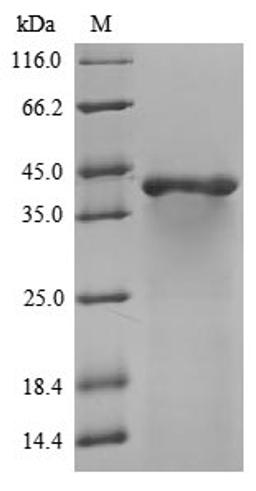 (Tris-Glycine gel) Discontinuous SDS-PAGE (reduced) with 5% enrichment gel and 15% separation gel.