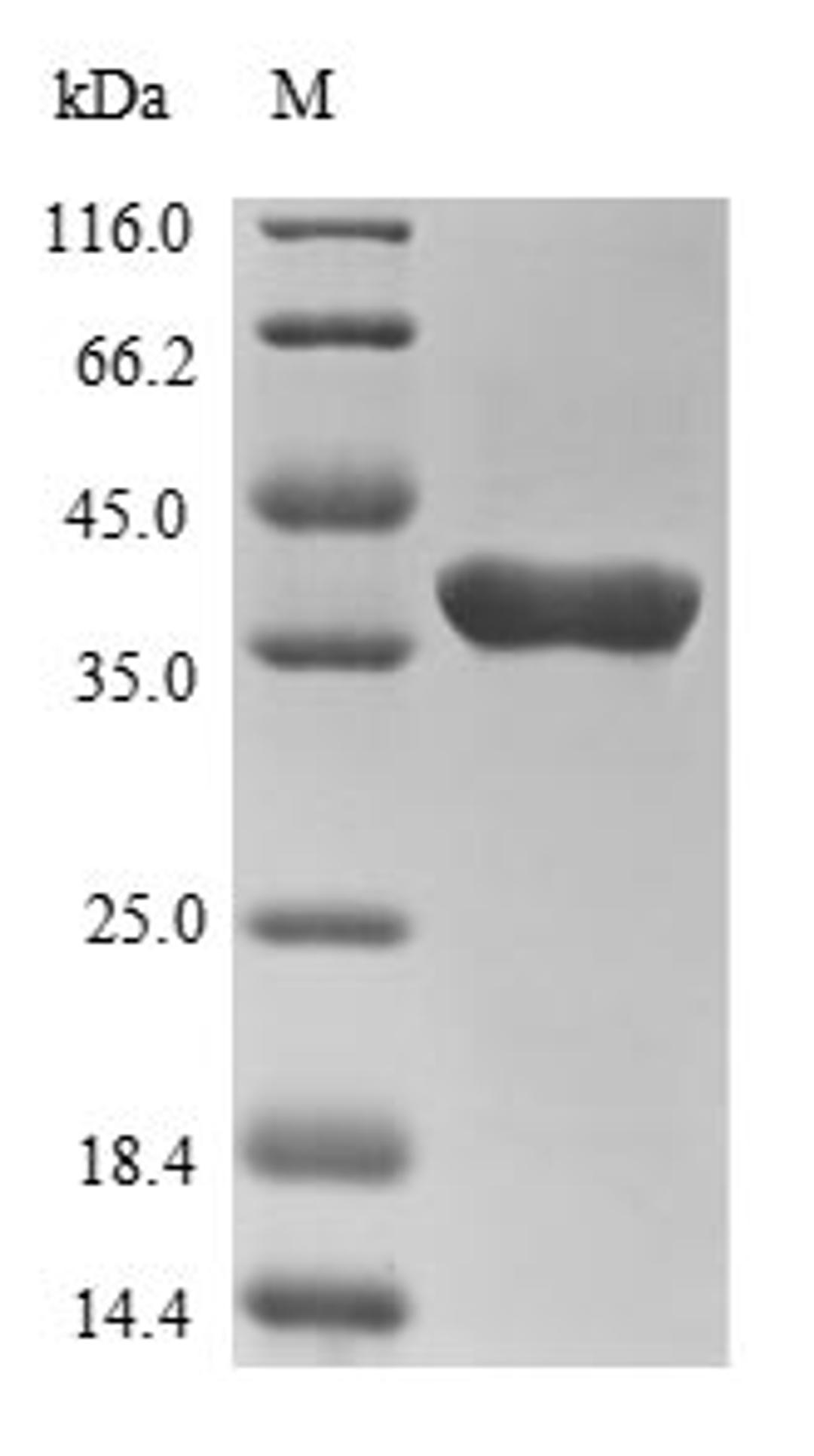 (Tris-Glycine gel) Discontinuous SDS-PAGE (reduced) with 5% enrichment gel and 15% separation gel.