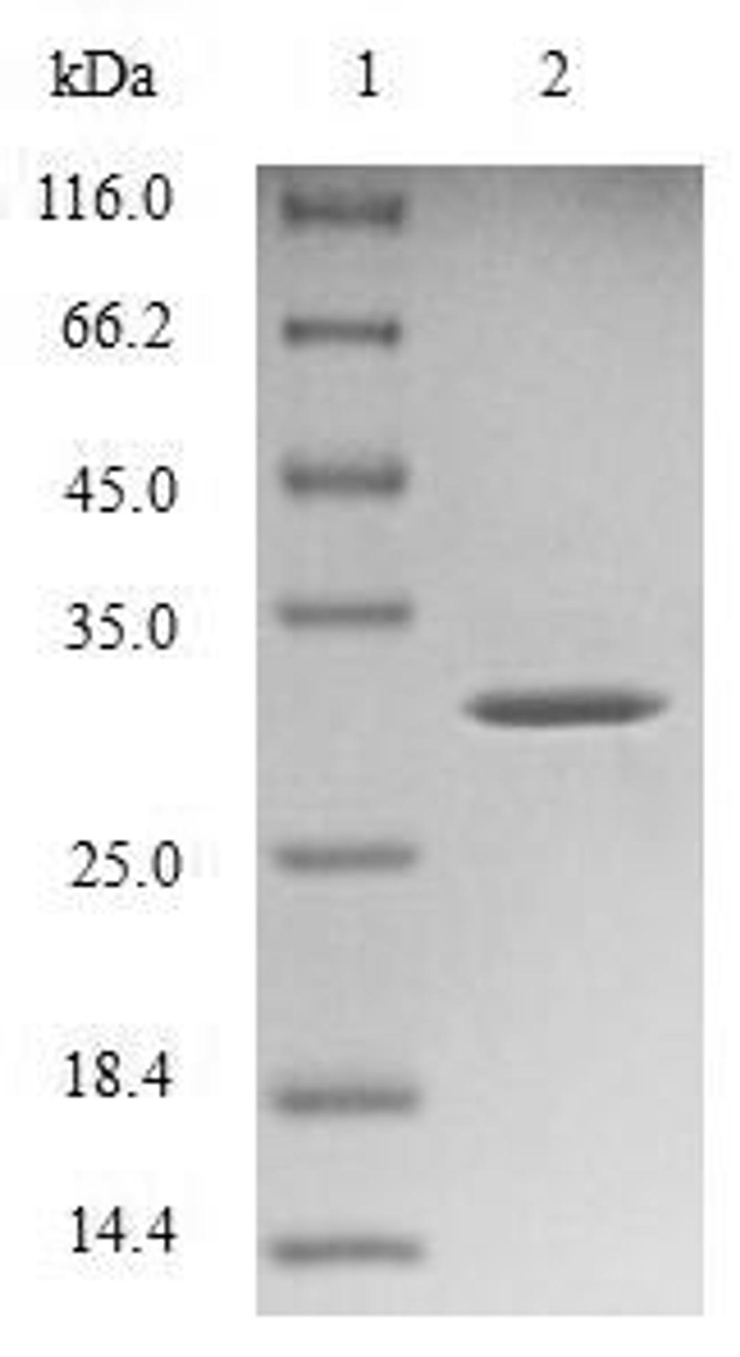 (Tris-Glycine gel) Discontinuous SDS-PAGE (reduced) with 5% enrichment gel and 15% separation gel.
