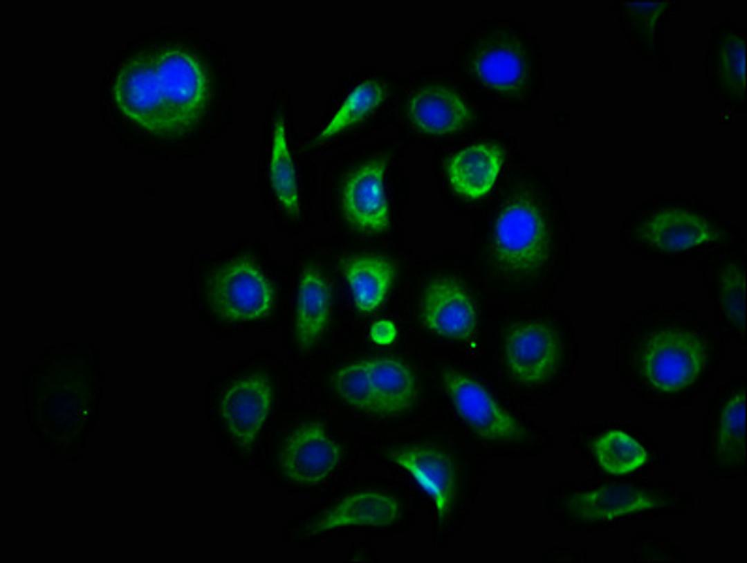 Immunofluorescence staining of A549 cells with CSB-PA349825HA01HU at 1:133, counter-stained with DAPI. The cells were fixed in 4% formaldehyde, permeabilized using 0.2% Triton X-100 and blocked in 10% normal Goat Serum. The cells were then incubated with the antibody overnight at 4°C. The secondary antibody was Alexa Fluor 488-congugated AffiniPure Goat Anti-Rabbit IgG(H+L).