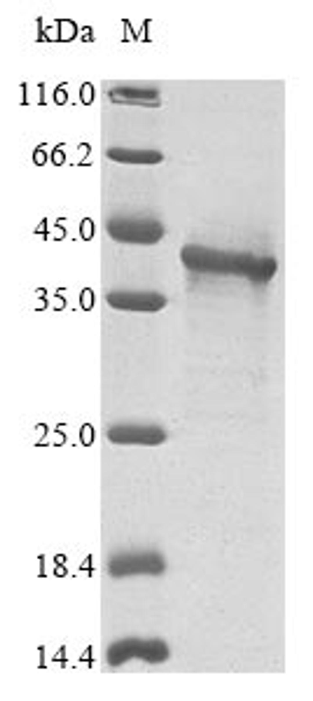 (Tris-Glycine gel) Discontinuous SDS-PAGE (reduced) with 5% enrichment gel and 15% separation gel.