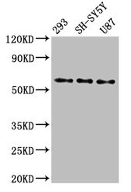 Western Blot. Positive WB detected in: 293 whole cell lysate, SH-SY5Y whole cell lysate, U87 whole cell lysate. All lanes: SLC11A2 antibody at 3ug/ml. Secondary. Goat polyclonal to rabbit IgG at 1/50000 dilution. Predicted band size: 63, 62, 65, 66 kDa. Observed band size: 63 kDa.