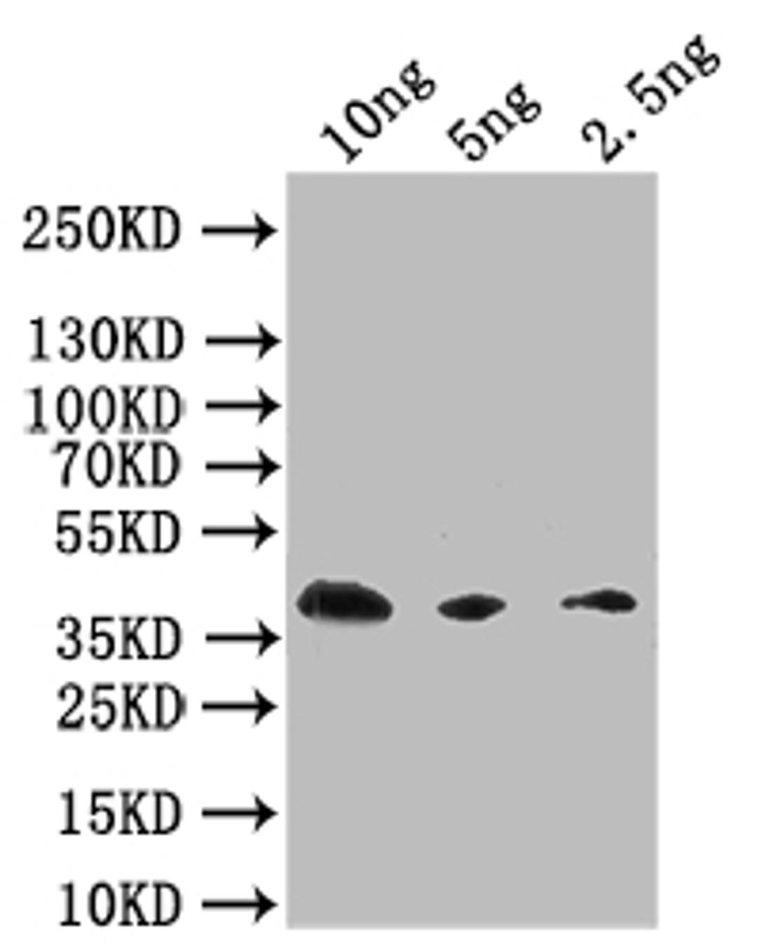 Western Blot. Positive WB detected in: recombinant protein. All lanes: Extracellular calcium-sensing receptor  Antibody at 1:1000. Secondary. Goat polyclonal to rabbit IgG at 1/50000 dilution. Predicted band size: 38 kDa. Observed band size: 38 kDa. 