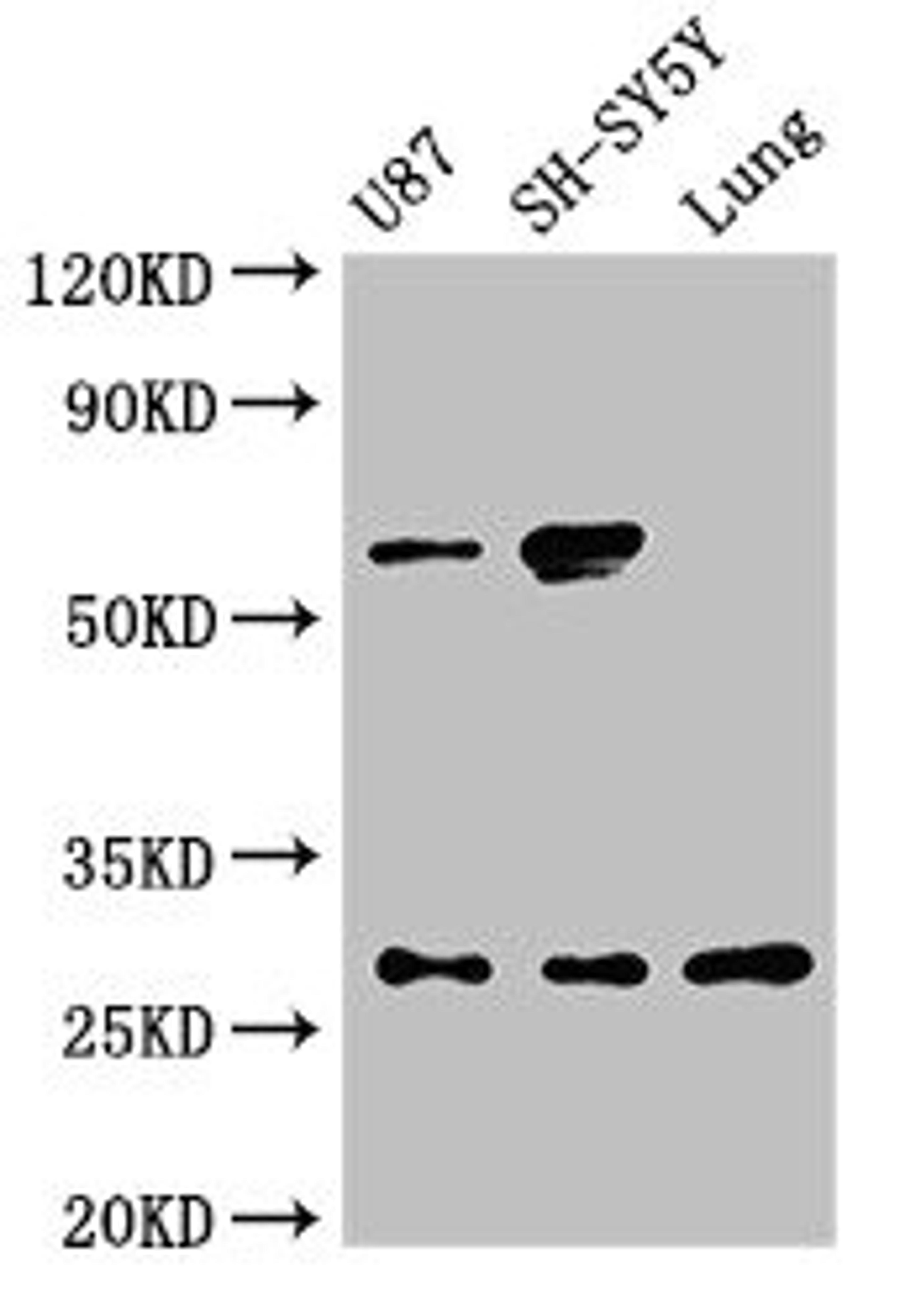 Western Blot. Positive WB detected in: U87 whole cell lysate, SH-SY5Y whole cell lysate, Rat lung tissue. All lanes: NEUROG2 antibody at 3ug/ml. Secondary. Goat polyclonal to rabbit IgG at 1/50000 dilution. Predicted band size: 29 kDa. Observed band size: 29, 60 kDa. 
