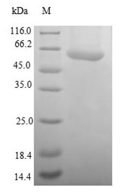 (Tris-Glycine gel) Discontinuous SDS-PAGE (reduced) with 5% enrichment gel and 15% separation gel.