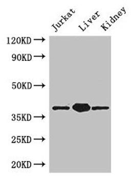 Western Blot. Positive WB detected in: Jurkat whole cell lysate, Mouse liver tissue, Mouse kidney tissue. All lanes: PINX1 antibody at 3.4µg/ml. Secondary. Goat polyclonal to rabbit IgG at 1/50000 dilution. Predicted band size: 38, 20 kDa. Observed band size: 38 kDa