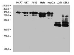 Western Blot. Positive WB detected in: MCF7 whole cell lysate, U87 whole cell lysate, A549 whole cell lysate, Hela whole cell lysate, HepG2 whole cell lysate, U251 whole cell lysate, K562 whole cell lysate . All lanes: CANX antibody at 1:2000. Secondary. Goat polyclonal to mouse IgG at 1/50000 dilution. Predicted band size: 68, 72, 56 kDa. Observed band size: 90 KDa. Exposure time：1min