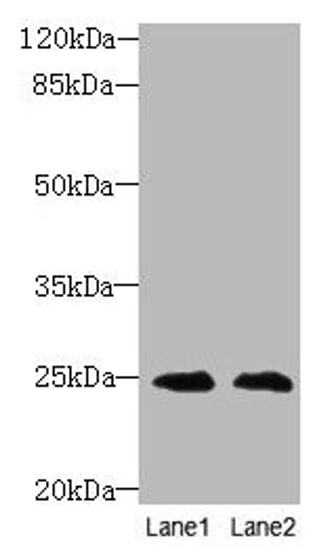 Western blot. All lanes: TIMP3 antibody at 2µg/ml. Lane 1: EC109 whole cell lysate. Lane 2: 293T whole cell lysate. Secondary. Goat polyclonal to rabbit IgG at 1/10000 dilution. Predicted band size: 25 kDa. Observed band size: 25 kDa