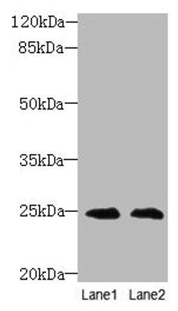 Western blot. All lanes: TIMP3 antibody at 2µg/ml. Lane 1: EC109 whole cell lysate. Lane 2: 293T whole cell lysate. Secondary. Goat polyclonal to rabbit IgG at 1/10000 dilution. Predicted band size: 25 kDa. Observed band size: 25 kDa