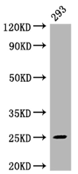 Western Blot. Positive WB detected in: 293 whole cell lysate. All lanes: Mad2L2 antibody at 1:2000. Secondary. Goat polyclonal to rabbit IgG at 1/50000 dilution. Predicted band size: 25 kDa. Observed band size: 25 kDa. 