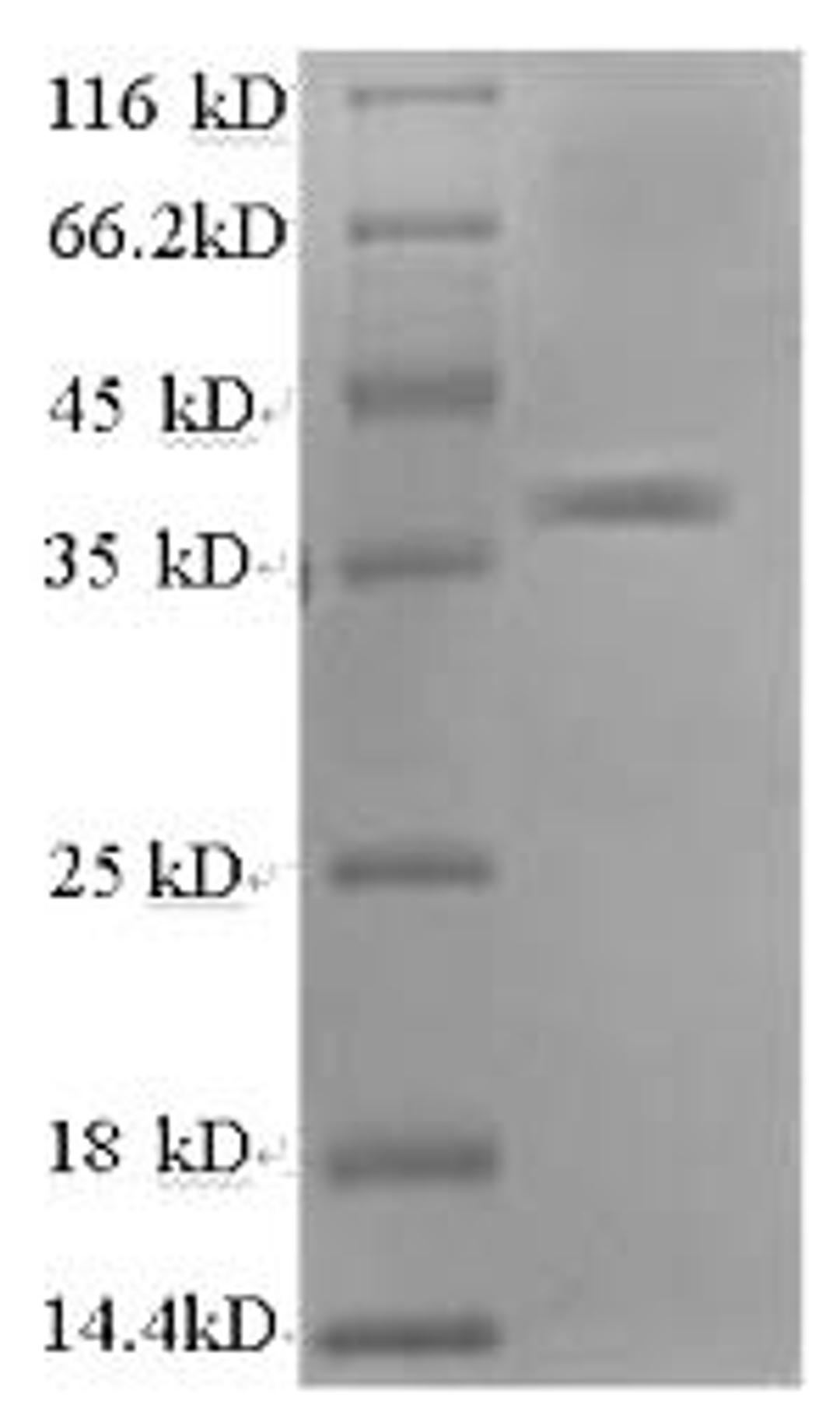 (Tris-Glycine gel) Discontinuous SDS-PAGE (reduced) with 5% enrichment gel and 15% separation gel.