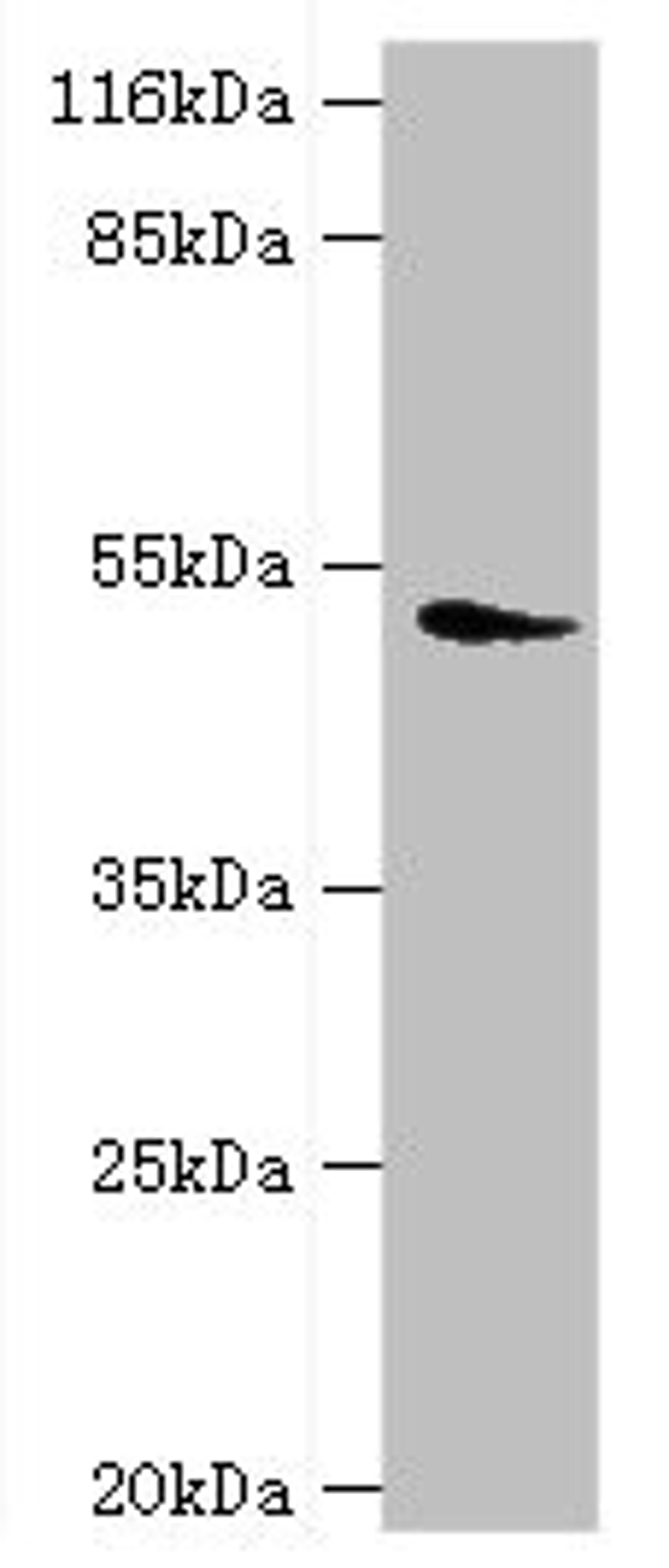 Western blot. All lanes: DRD5 antibody at 2µg/ml + Mouse brain tissue. Secondary. Goat polyclonal to rabbit IgG at 1/10000 dilution. Predicted band size: 53 kDa. Observed band size: 53 kDa