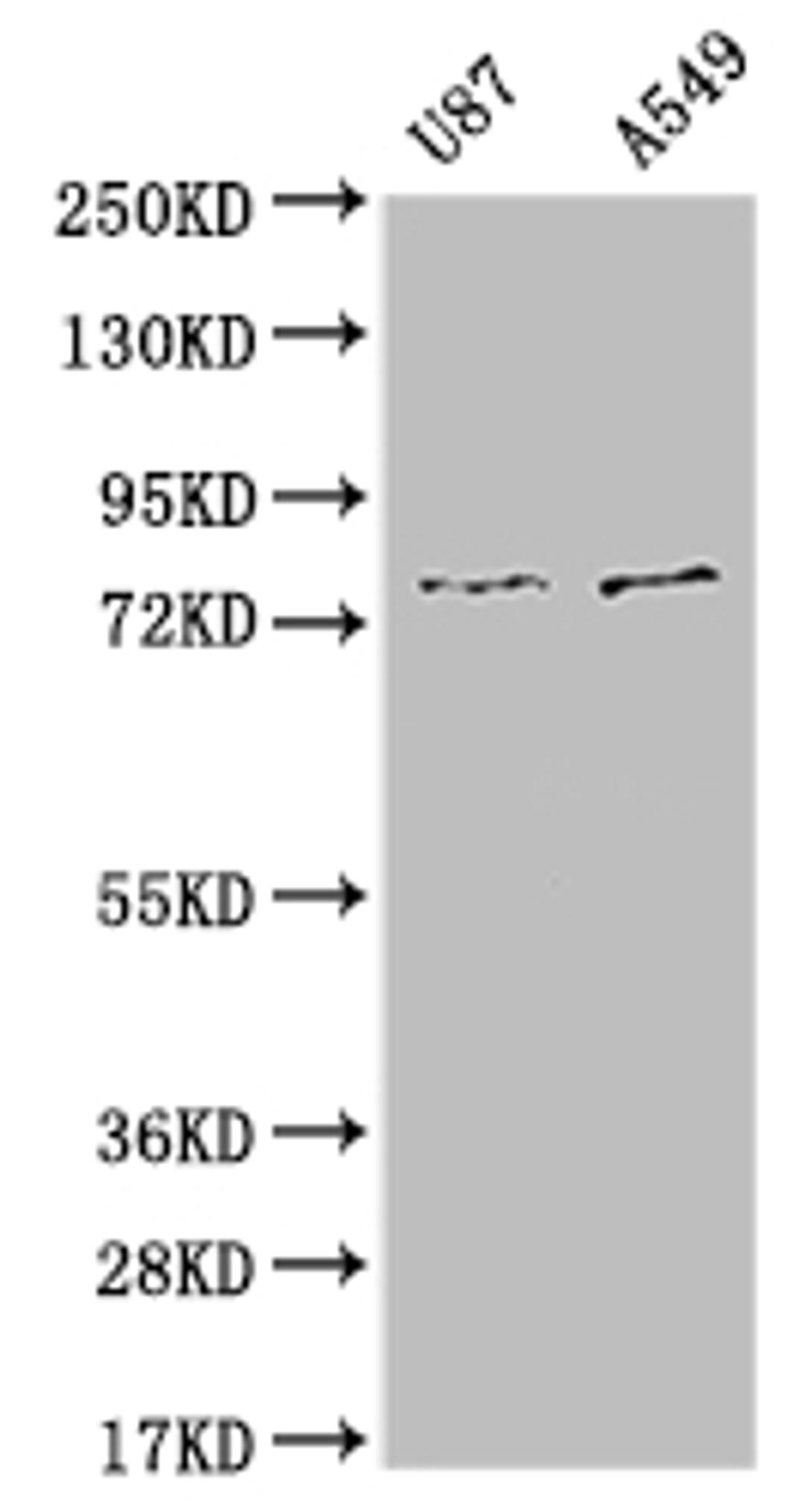 Western Blot. Positive WB detected in: U87 whole cell lysate, A549 whole cell lysate. All lanes: SLC25A12 antibody at 1:1000. Secondary. Goat polyclonal to rabbit IgG at 1/50000 dilution. Predicted band size: 75, 63 kDa. Observed band size: 72-80 kDa. 