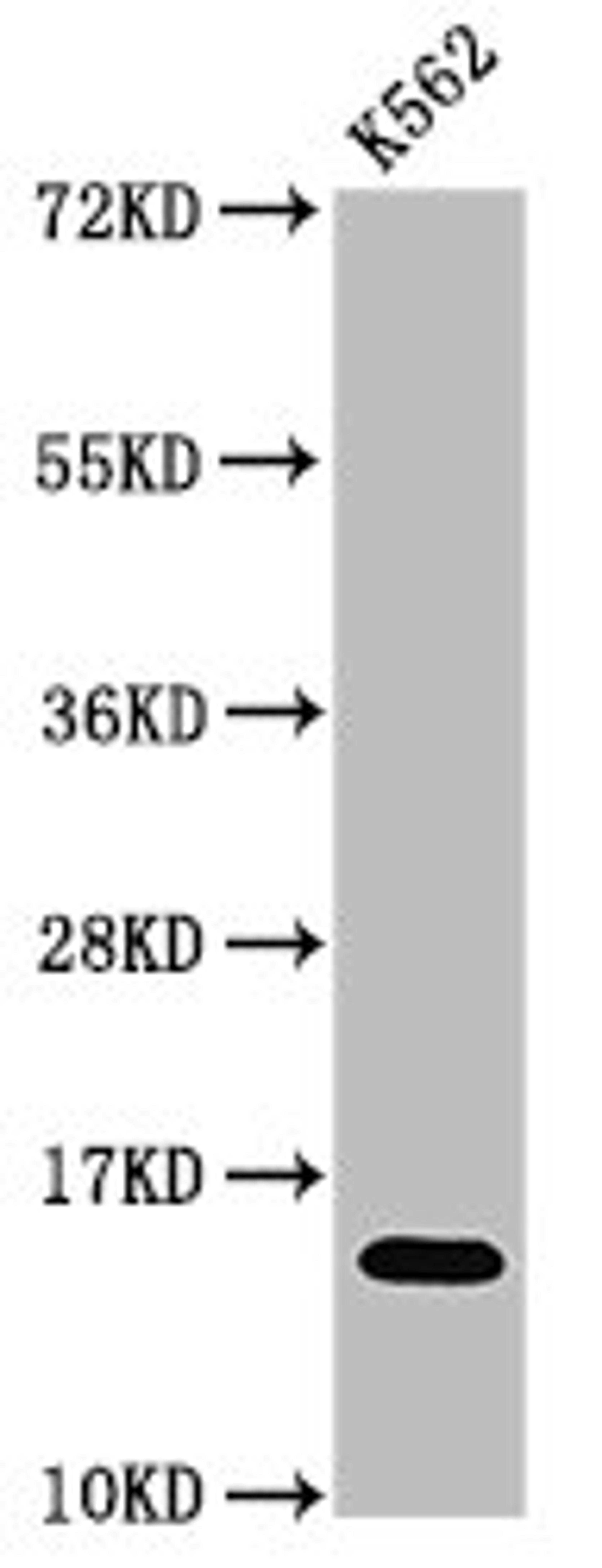 Western Blot. Positive WB detected in: K562 cell acid extracts. All lanes: HIST1H2AG antibody at 0.75µg/ml. Secondary. Goat polyclonal to rabbit IgG at 1/50000 dilution. Predicted band size: 15 kDa. Observed band size: 15 kDa