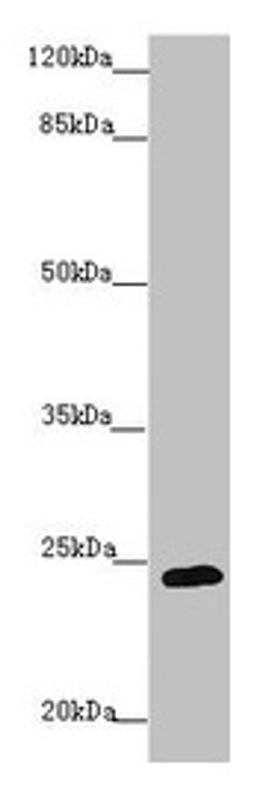 Western blot. All lanes: GRPEL1 antibody at 1.37µg/ml + 293T whole cell lysate. Secondary. Goat polyclonal to rabbit IgG at 1/10000 dilution. Predicted band size: 24 kDa. Observed band size: 24 kDa