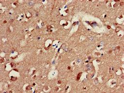 Immunohistochemistry of paraffin-embedded human brain tissue using CSB-PA009141LA01HU at dilution of 1:100