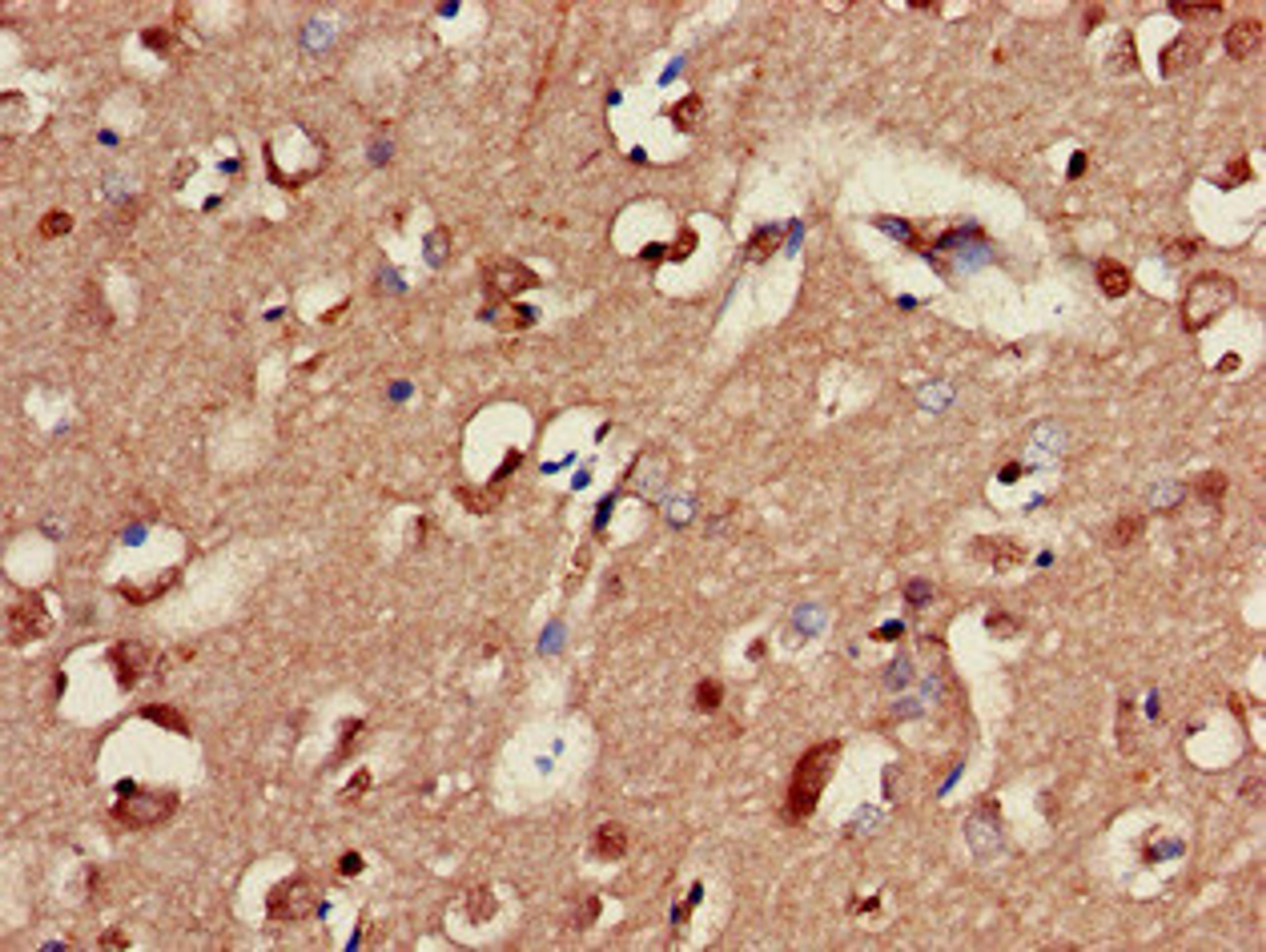 Immunohistochemistry of paraffin-embedded human brain tissue using CSB-PA009141LA01HU at dilution of 1:100
