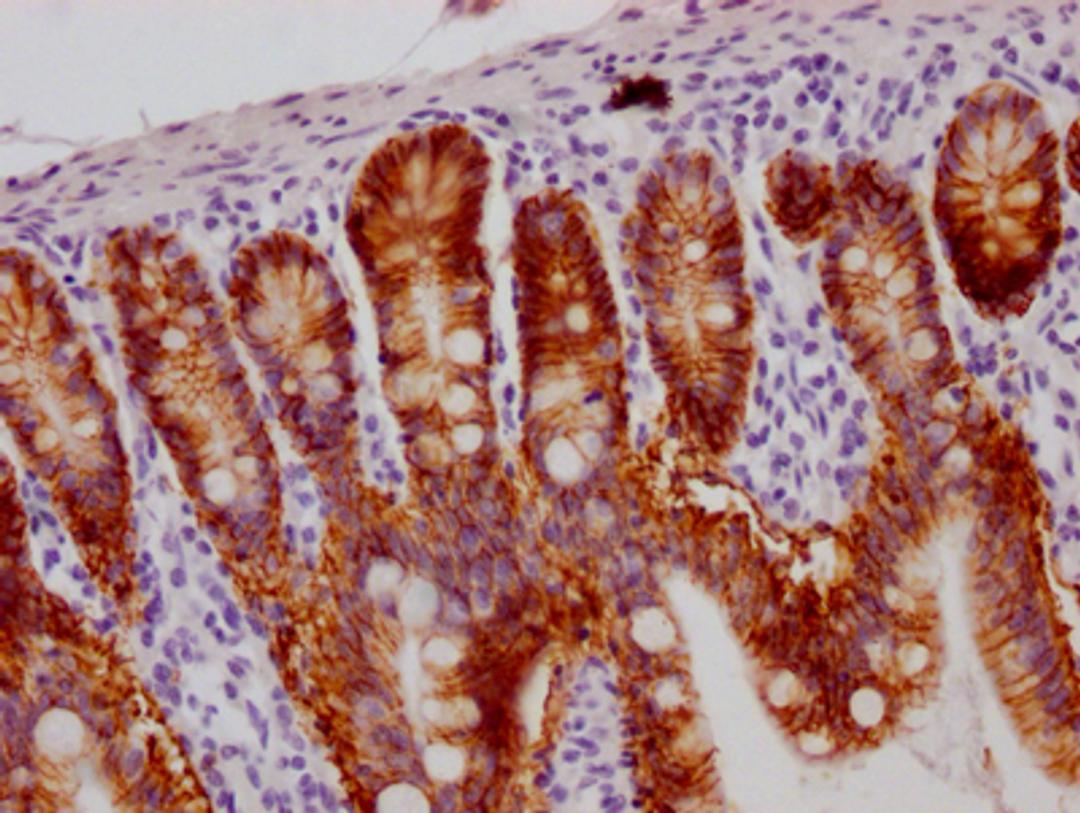 IHC image of CSB-RA245537A0HU diluted at 1:100 and staining in paraffin-embedded human small intestine tissue performed on a Leica BondTM system. After dewaxing and hydration, antigen retrieval was mediated by high pressure in a citrate buffer (pH 6.0). Section was blocked with 10% normal goat serum 30min at RT. Then primary antibody (1% BSA) was incubated at 4℃ overnight. The primary is detected by a Goat anti-rabbit IgG polymer labeled by HRP and visualized using 0.05% DAB.