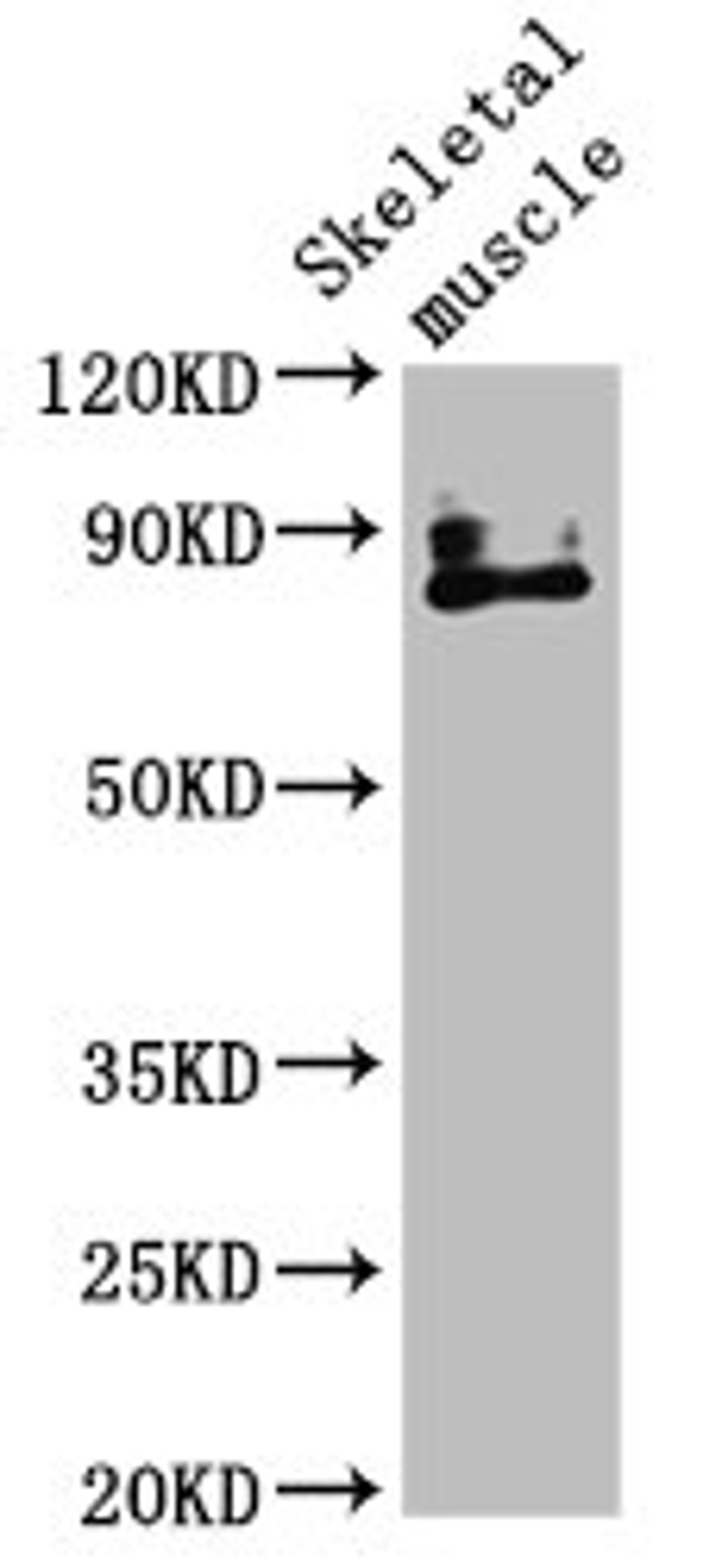 Western Blot. Positive WB detected in: Mouse skeletal muscle tissue. All lanes: TRPV2 antibody at 4.51ug/ml. Secondary. Goat polyclonal to rabbit IgG at 1/50000 dilution. Predicted band size: 86 kDa. Observed band size: 86 kDa. 