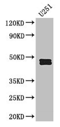 Western Blot. Positive WB detected in: U251 whole cell lysate. All lanes: SERPINE1 antibody at 2.5µg/ml. Secondary. Goat polyclonal to rabbit IgG at 1/50000 dilution. Predicted band size: 46, 44 kDa. Observed band size: 46, 44 kDa