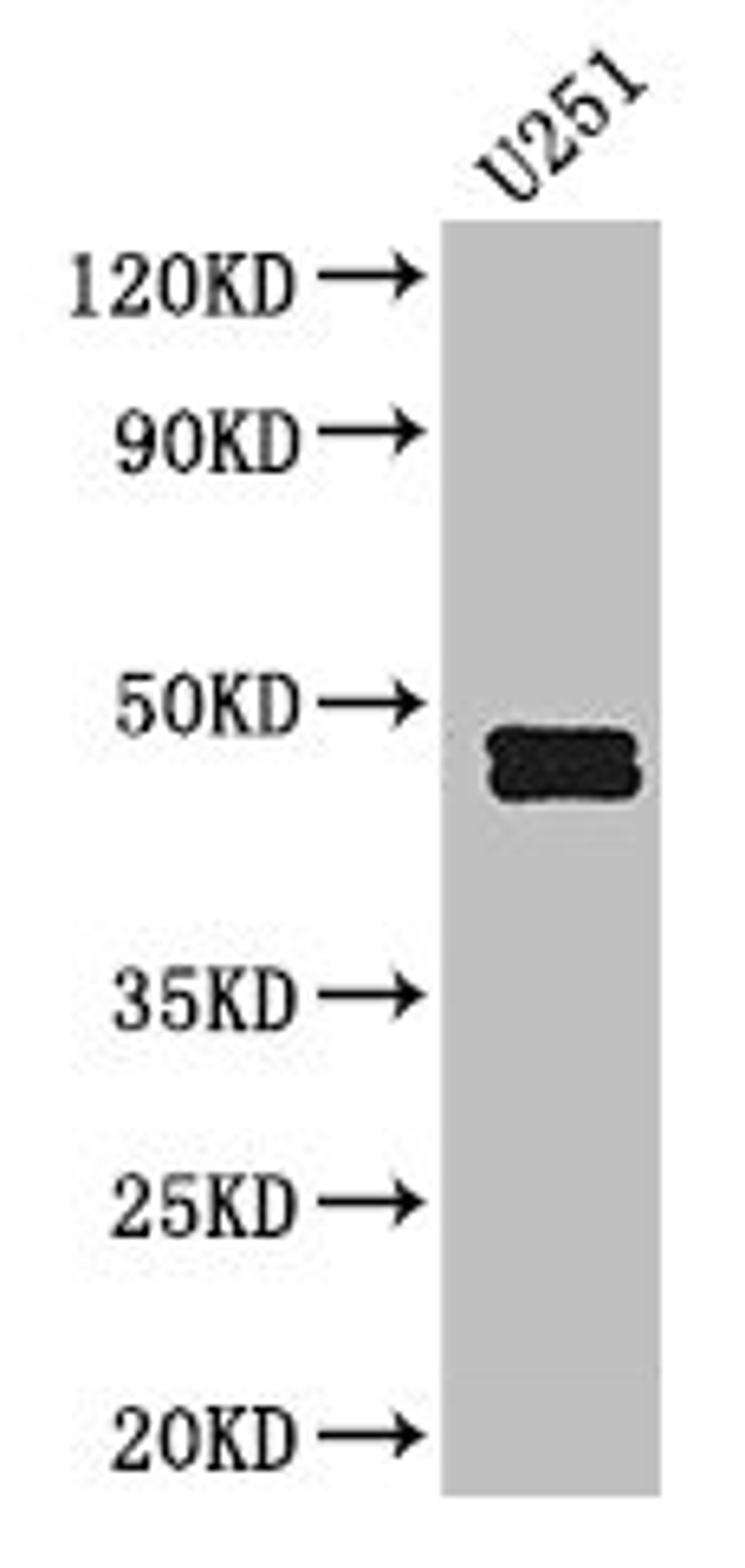 Western Blot. Positive WB detected in: U251 whole cell lysate. All lanes: SERPINE1 antibody at 2.5µg/ml. Secondary. Goat polyclonal to rabbit IgG at 1/50000 dilution. Predicted band size: 46, 44 kDa. Observed band size: 46, 44 kDa
