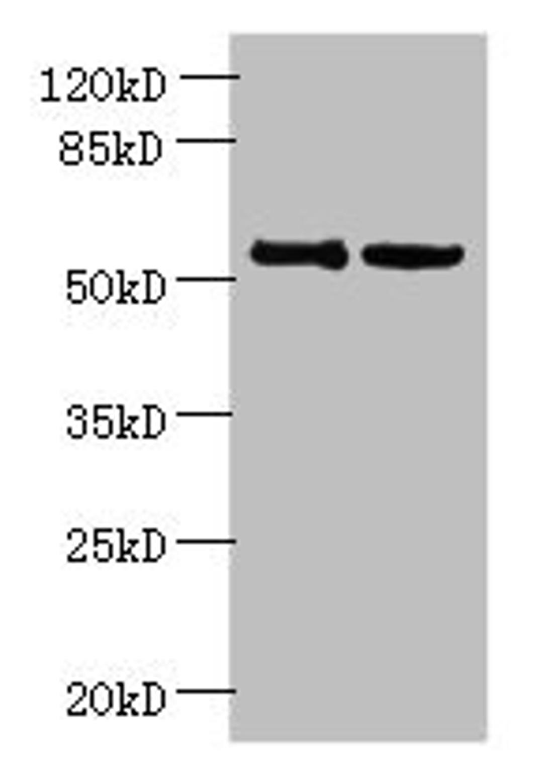 Western blot. All lanes: UTP15 antibody at 5µg/ml. Lane 1: Hela whole cell lysate. Lane 2: HepG2 whole cell lysate. Secondary. Goat polyclonal to rabbit IgG at 1/10000 dilution. Predicted band size: 59, 37, 57 kDa. Observed band size: 59 kDa