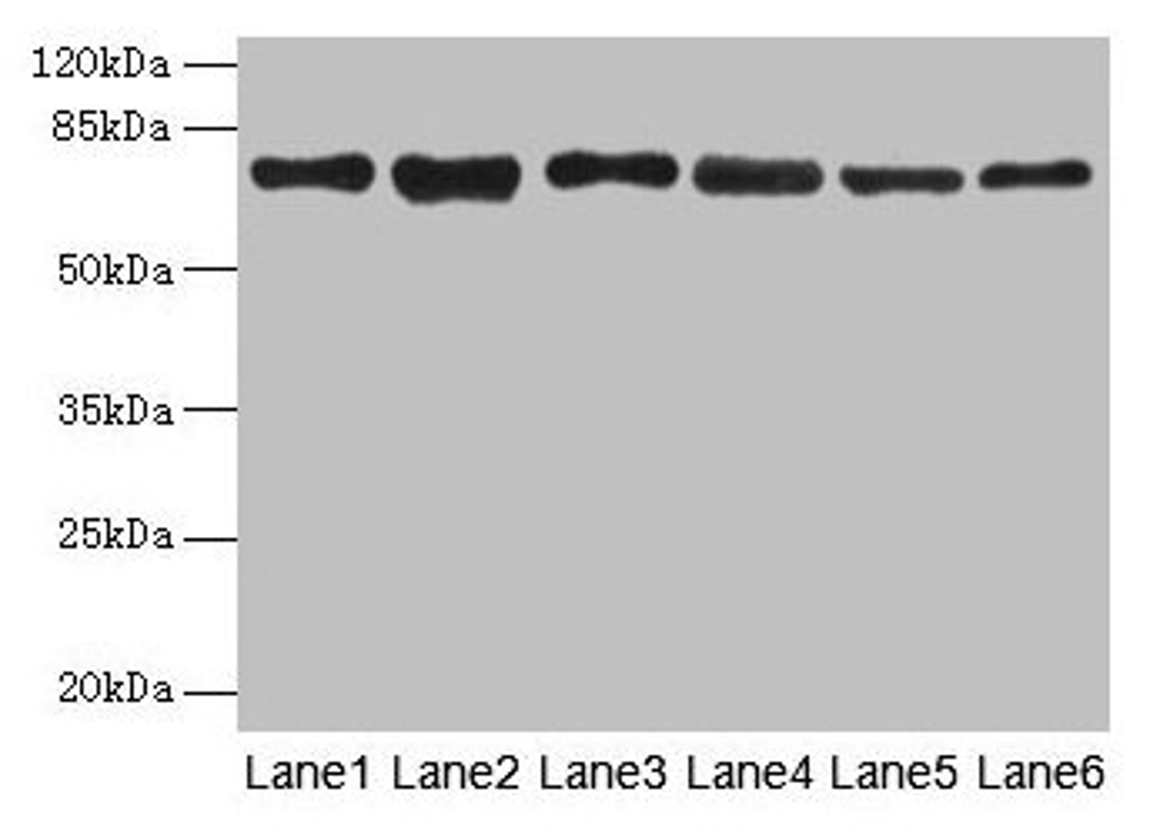 Western blot. All lanes: TMCC1 antibody at 1µg/ml. Lane 1: MCF-7 whole cell lysate. Lane 2: Mouse liver tissue. Lane 3: Mouse kidney tissue. Lane 4: HL60 whole cell lysate. Lane 5: K562 whole cell lysate. Lane 6: U937 whole cell lysate. Secondary. Goat polyclonal to rabbit IgG at 1/10000 dilution. Predicted band size: 73, 54 kDa. Observed band size: 73 kDa