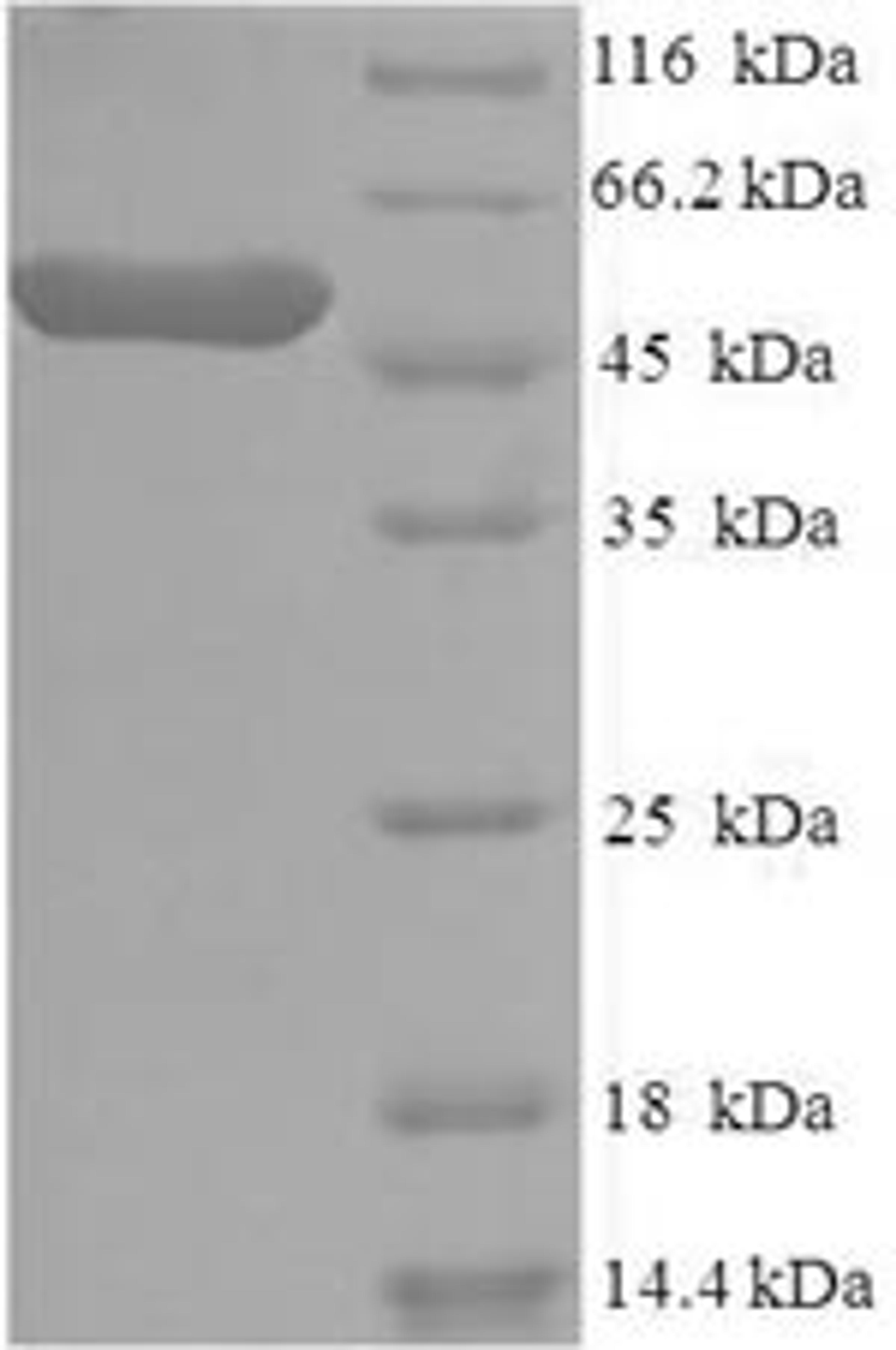 (Tris-Glycine gel) Discontinuous SDS-PAGE (reduced) with 5% enrichment gel and 15% separation gel.