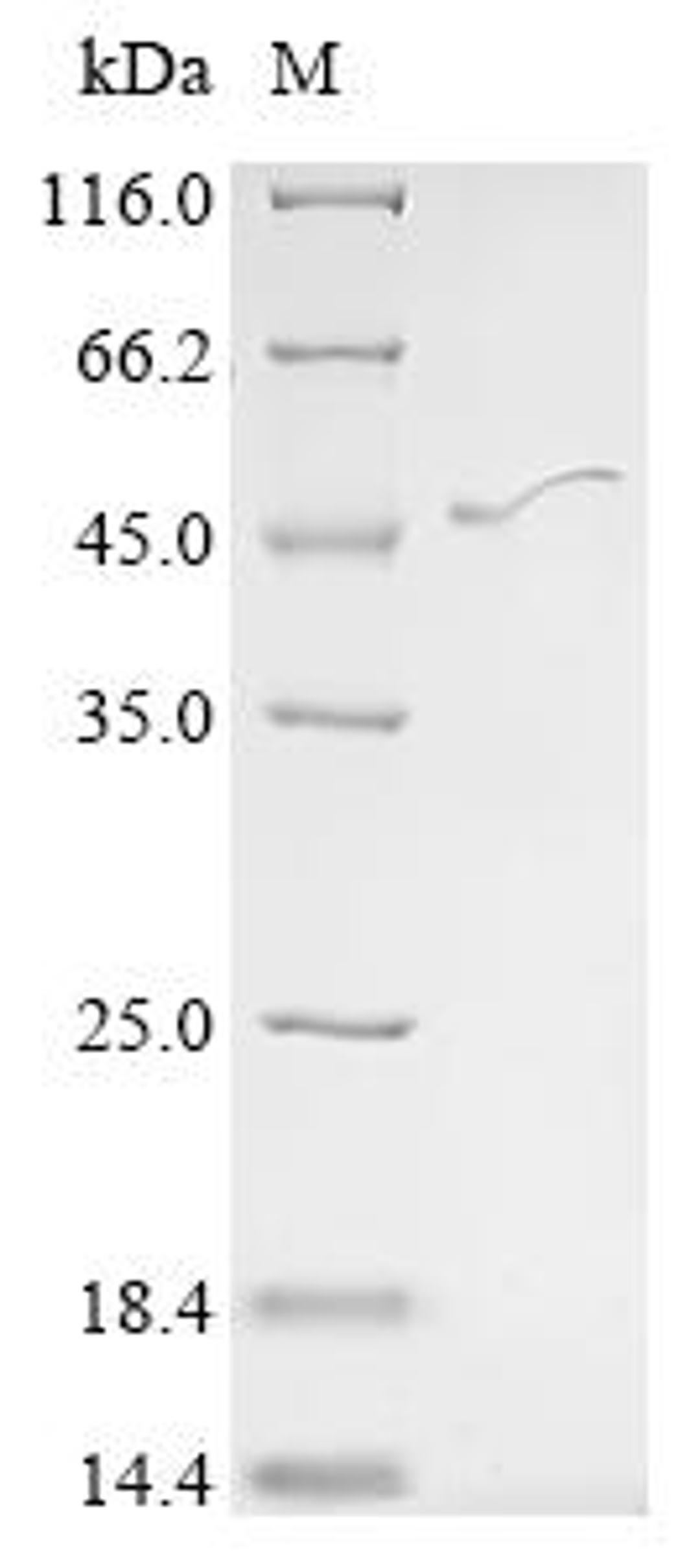 (Tris-Glycine gel) Discontinuous SDS-PAGE (reduced) with 5% enrichment gel and 15% separation gel.