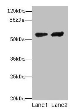 Western blot. All lanes: CYP17A1 antibody at 12µg/ml. Lane 1: Hela whole cell lysate. Lane 2: A549 whole cell lysate. Secondary. Goat polyclonal to rabbit IgG at 1/10000 dilution. Predicted band size: 58 kDa. Observed band size: 58 kDa