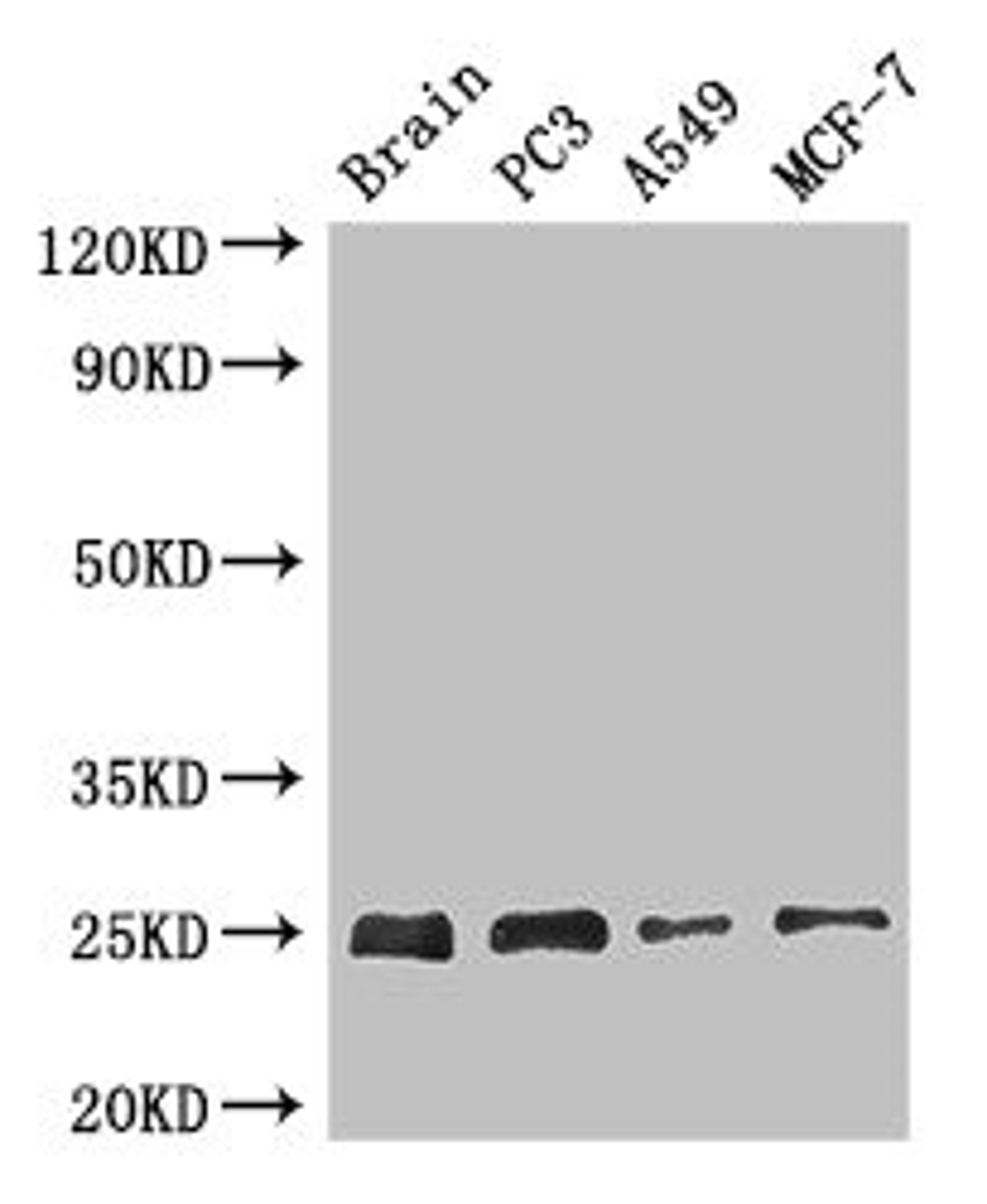 Western Blot. Positive WB detected in: Mouse brain tissue, PC-3 whole cell lysate, A549 whole cell lysate, MCF-7 whole cell lysate. All lanes: APOPT1 antibody at 2.7ug/ml. Secondary. Goat polyclonal to rabbit IgG at 1/50000 dilution. predicted band size: 25 kDa. observed band size: 25 kDa. 