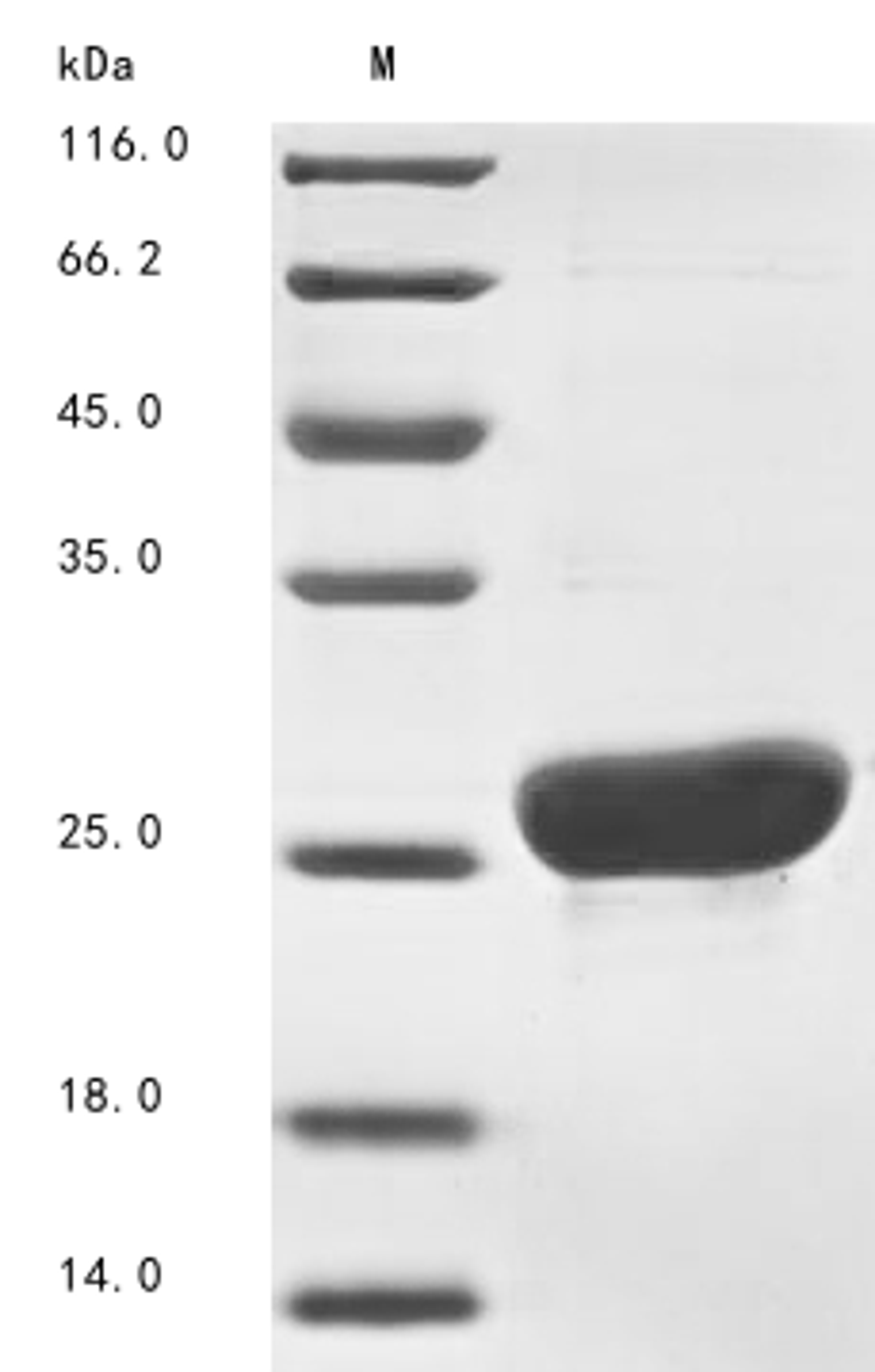 (Tris-Glycine gel) Discontinuous SDS-PAGE (reduced) with 5% enrichment gel and 15% separation gel.