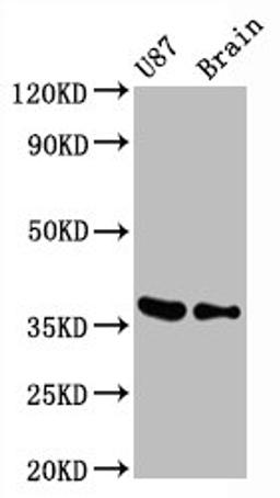 Western BlotPositive WB detected in U87 whole cell lysate, Mouse brain tissueAll lanes GAPDH antibody at 0.31μg/mlSecondaryGoat polyclonal to rabbit IgG at 1/50000 dilutionPredicted band size: 36 KDaObserved band size: 36 KDa