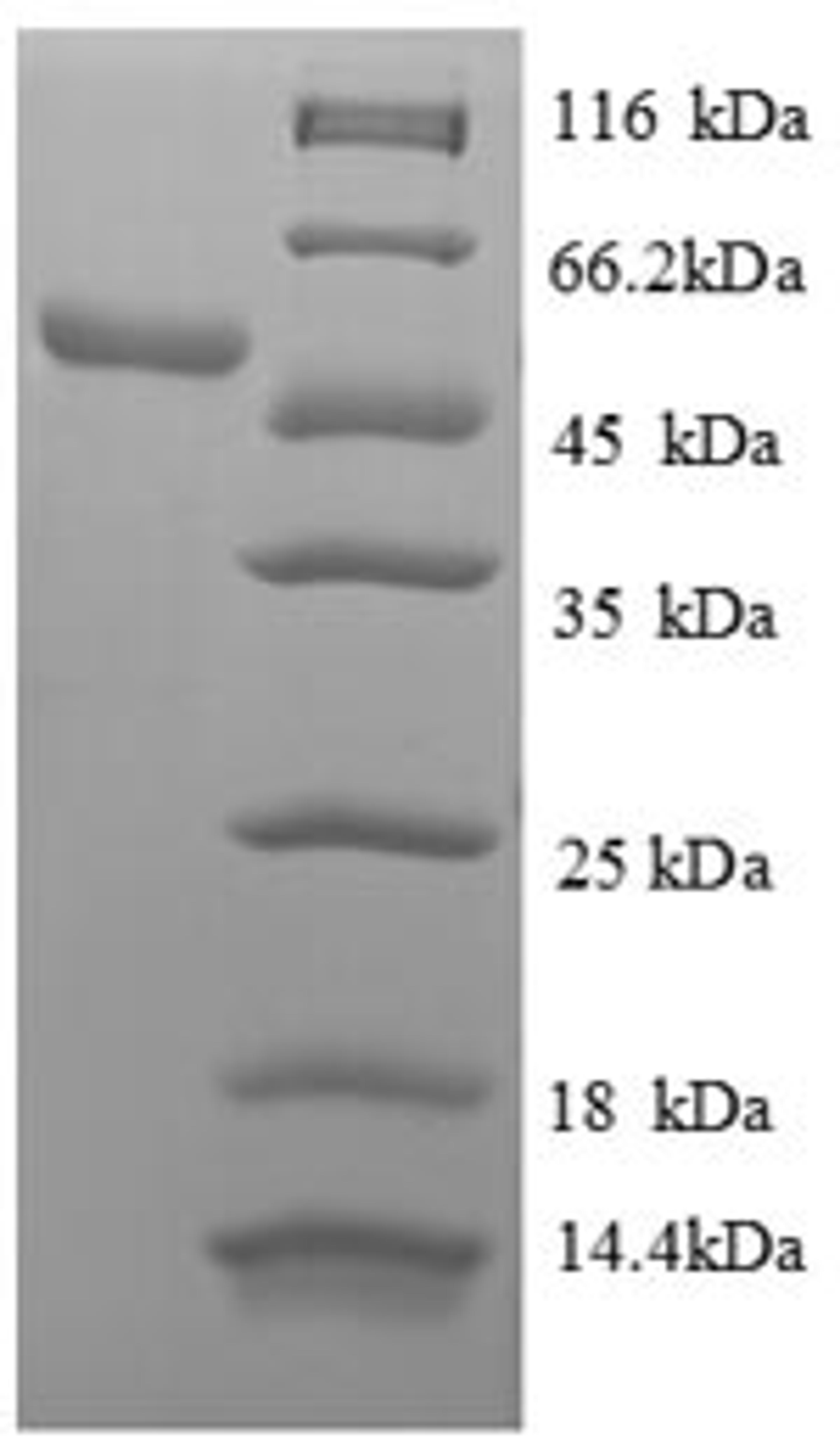 (Tris-Glycine gel) Discontinuous SDS-PAGE (reduced) with 5% enrichment gel and 15% separation gel.