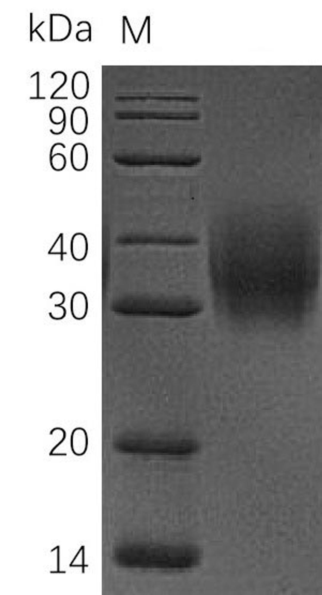 (Tris-Glycine gel) Discontinuous SDS-PAGE (reduced) with 5% enrichment gel and 15% separation gel.