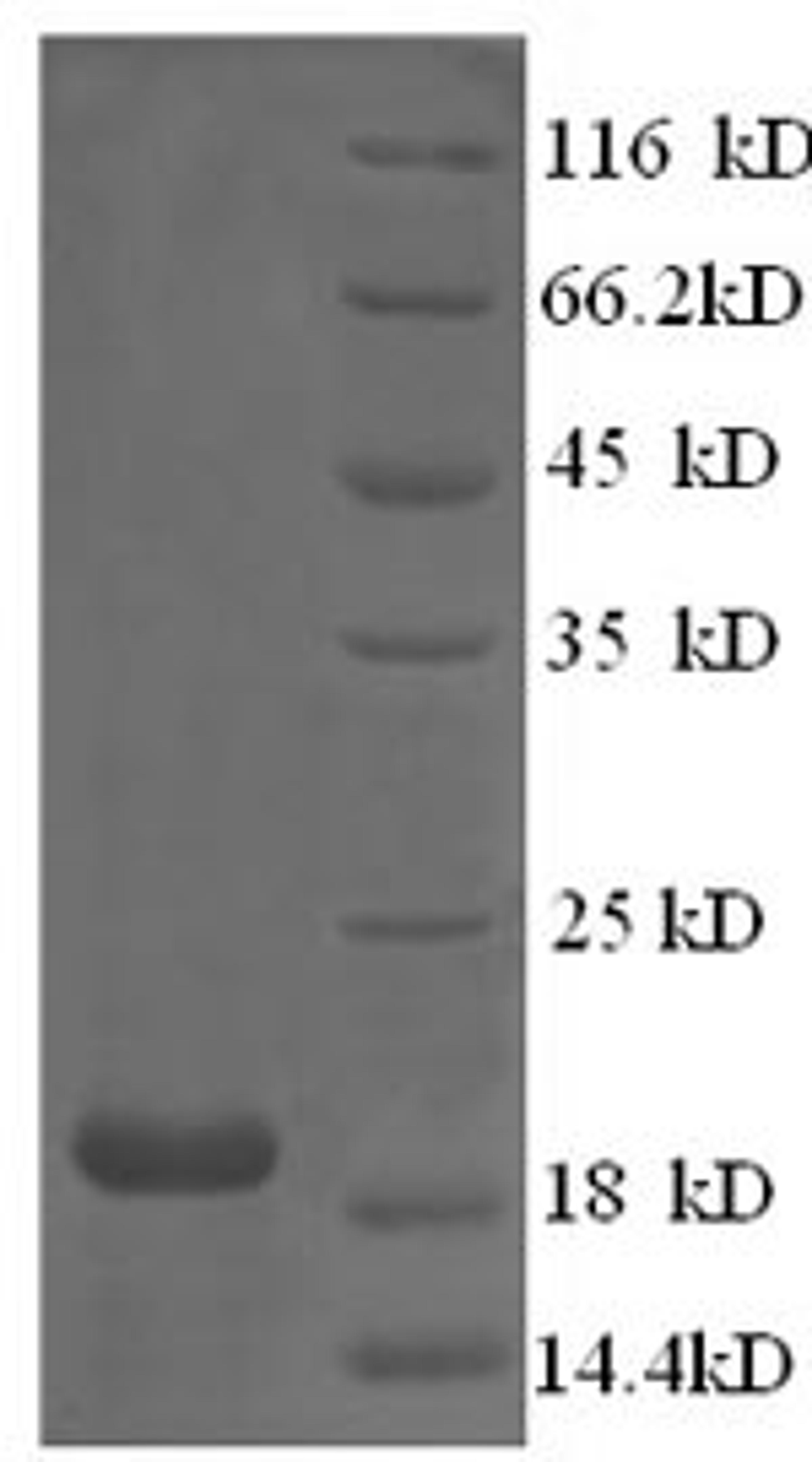 (Tris-Glycine gel) Discontinuous SDS-PAGE (reduced) with 5% enrichment gel and 15% separation gel.