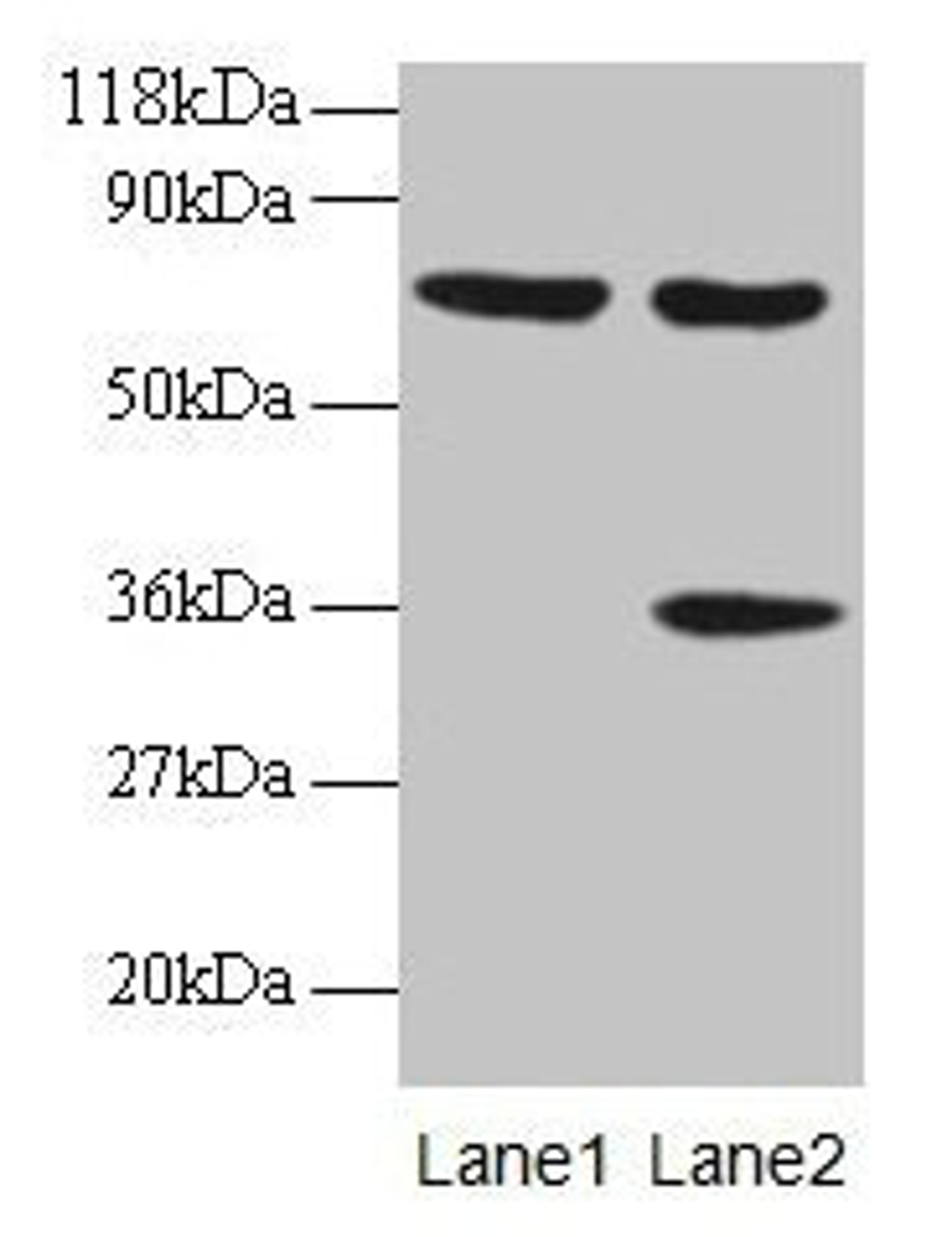 Western blot. All lanes: SYNCRIP antibody at 2µg/ml. Lane 1: EC109 whole cell lysate. Lane 2: 293T whole cell lysate. Secondary. Goat polyclonal to rabbit IgG at 1/15000 dilution. Predicted band size: 70, 66, 63, 59, 47 kDa. Observed band size: 70, 36 kDa