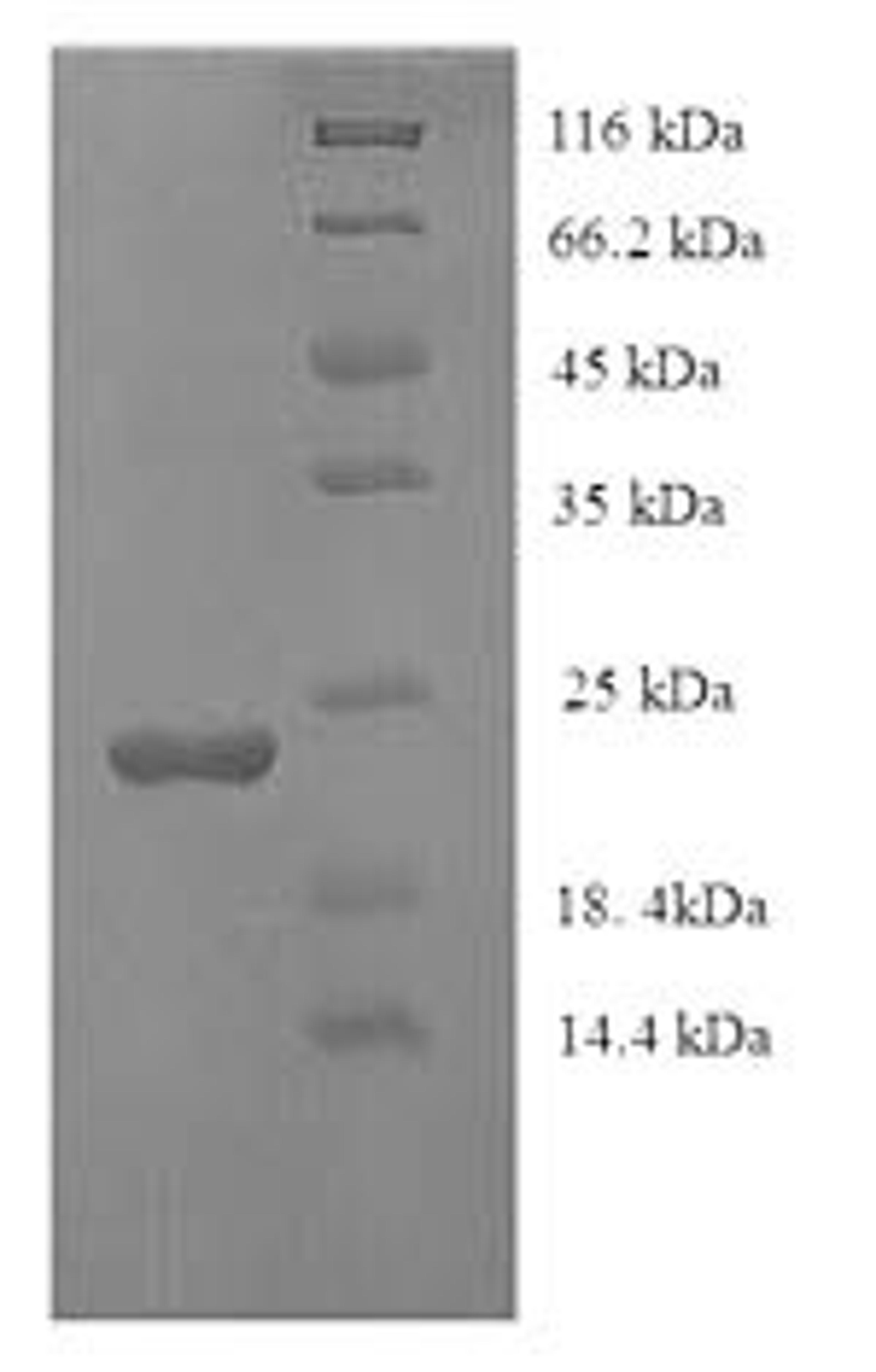 (Tris-Glycine gel) Discontinuous SDS-PAGE (reduced) with 5% enrichment gel and 15% separation gel.