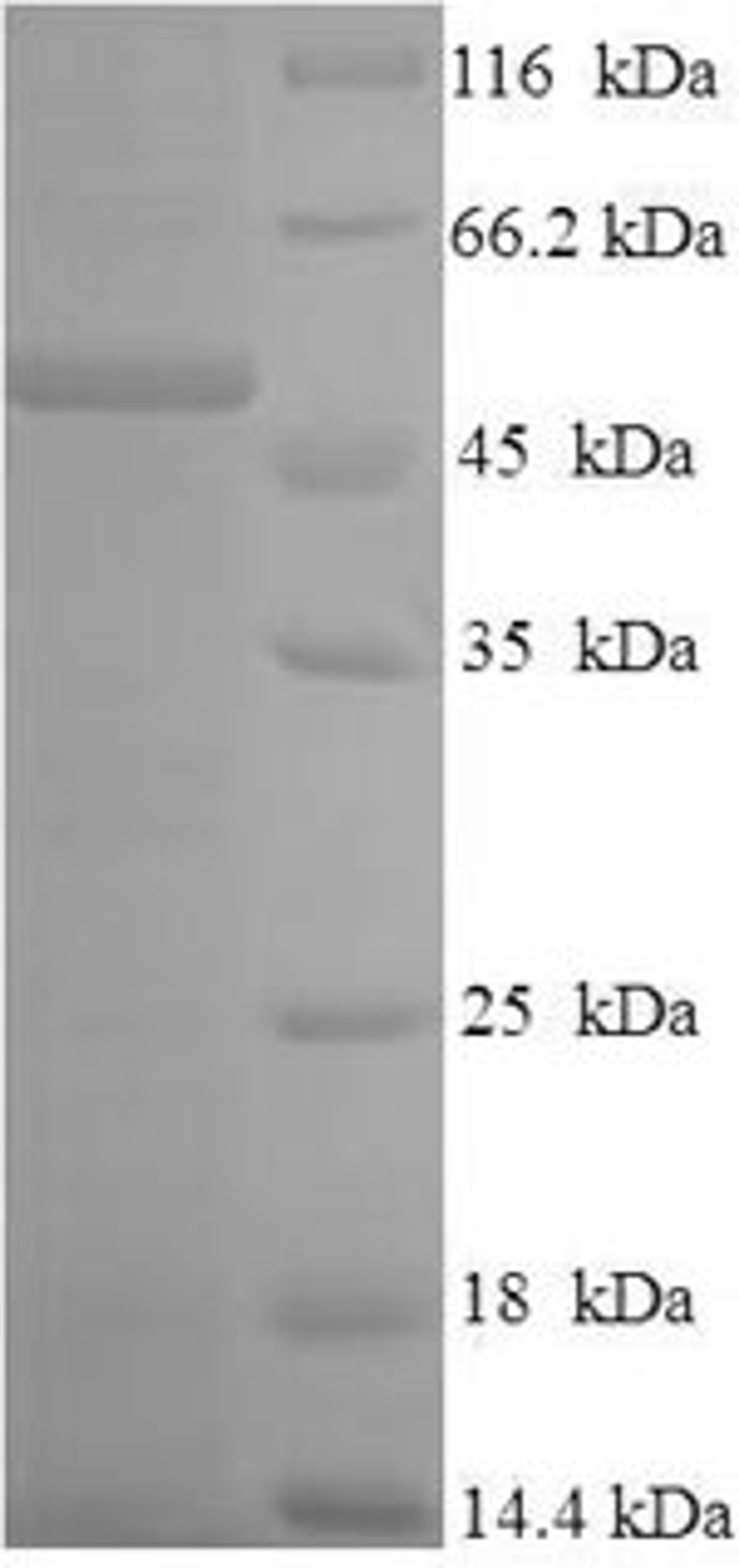 (Tris-Glycine gel) Discontinuous SDS-PAGE (reduced) with 5% enrichment gel and 15% separation gel.